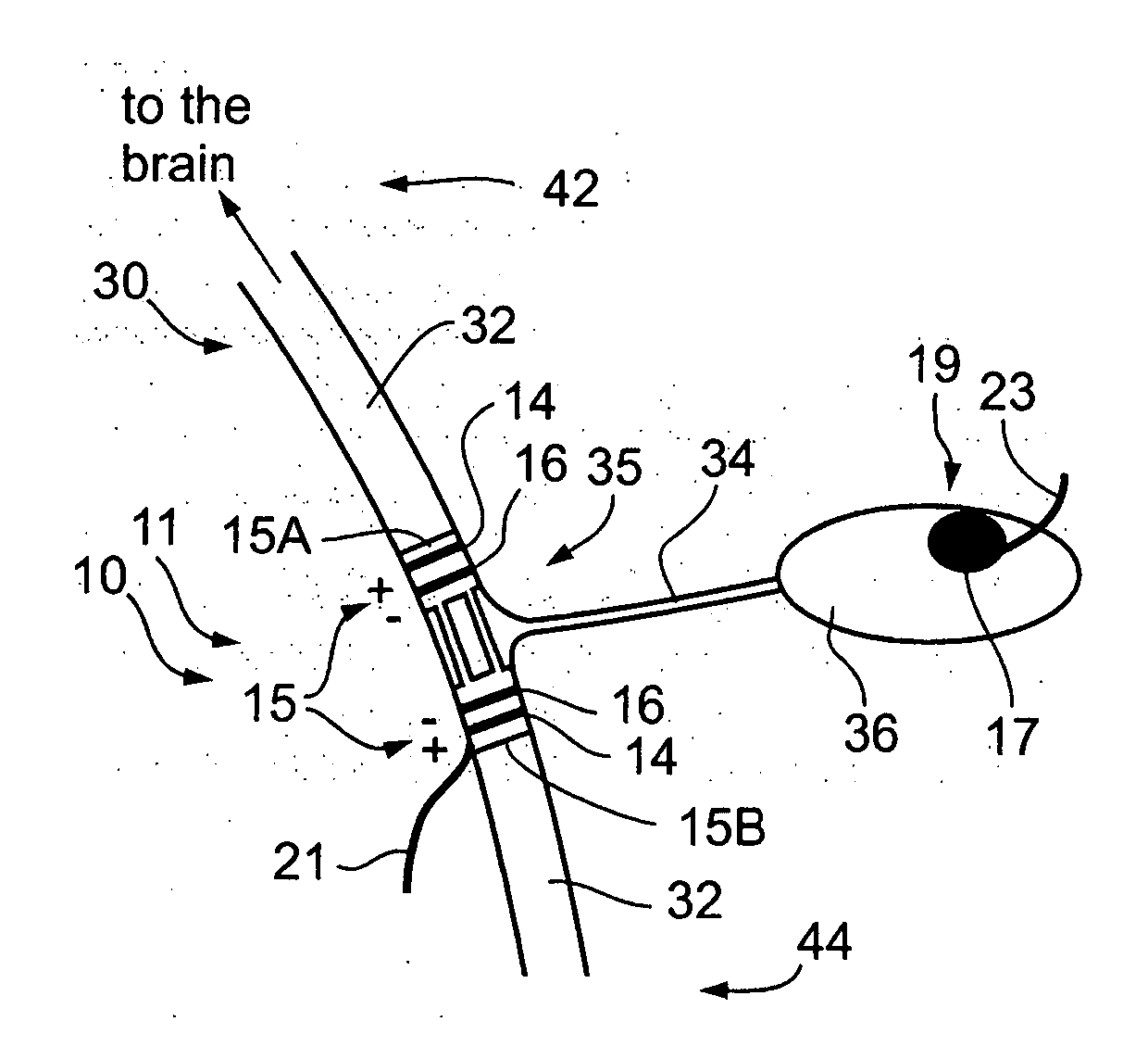 Nerve-branch-specific action-potential activation,inhibition, and monitoring