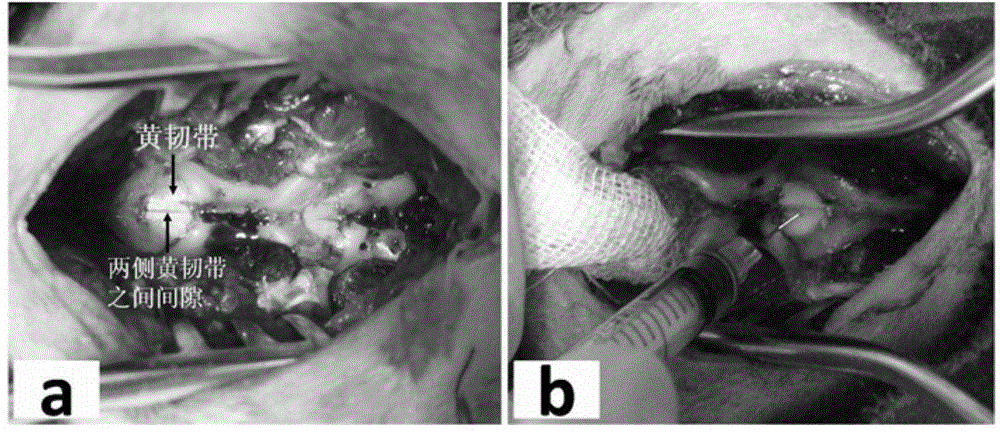 Building method for yellow ligament ossification animal model