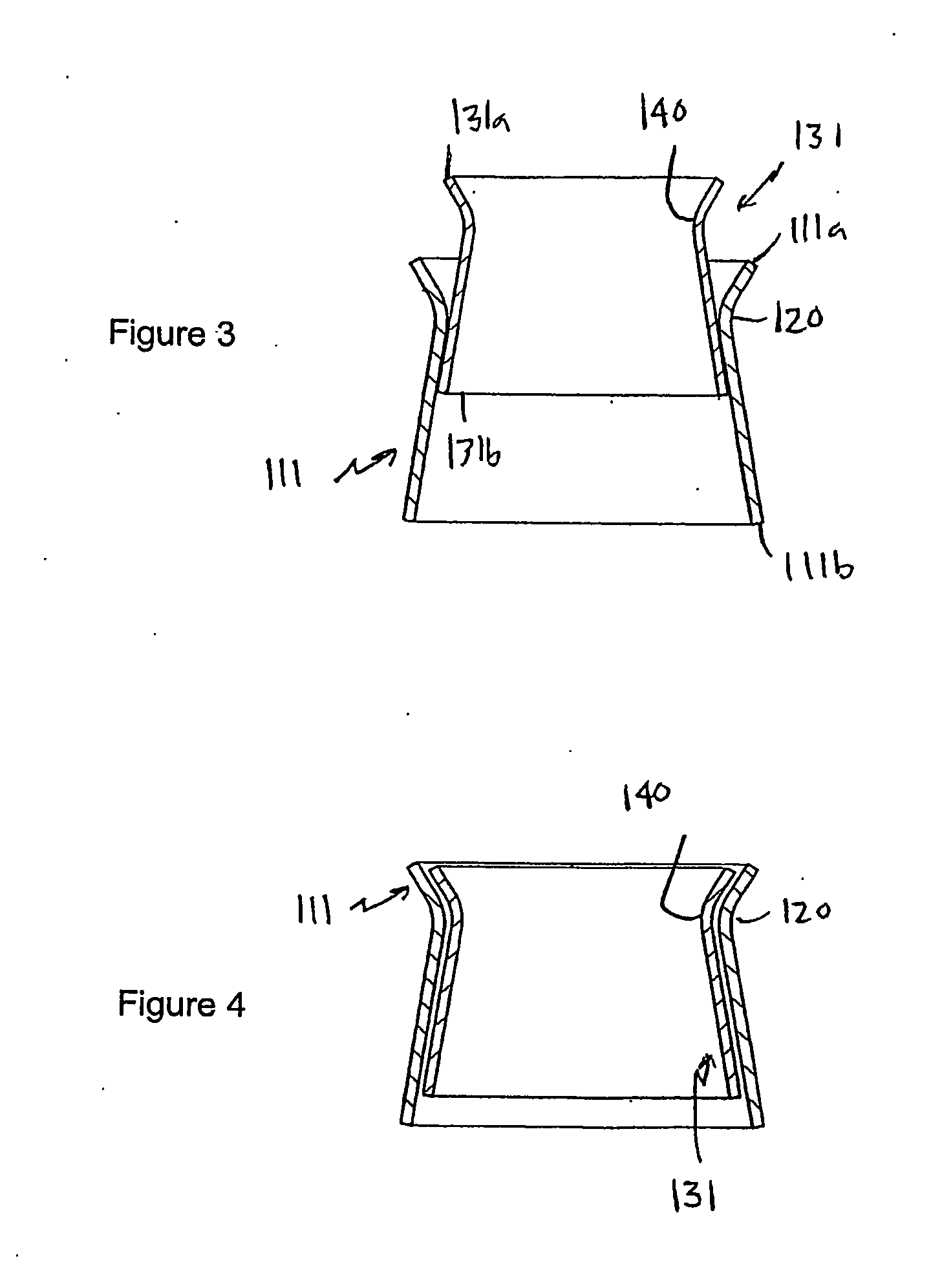 Heart valve prosthesis and method