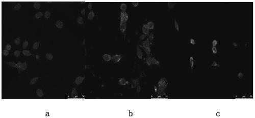 A method for preparing tumor antigen-specific CD8+ stem cell-like memory T lymphocytes in vitro