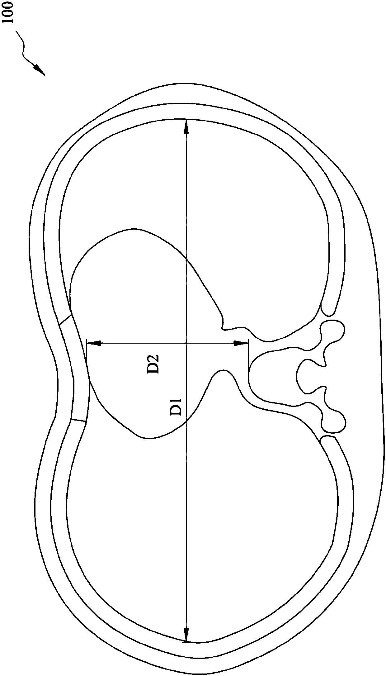 Manufacturing method applied to manufacture 3D printing simulation board of funnel chest correction board