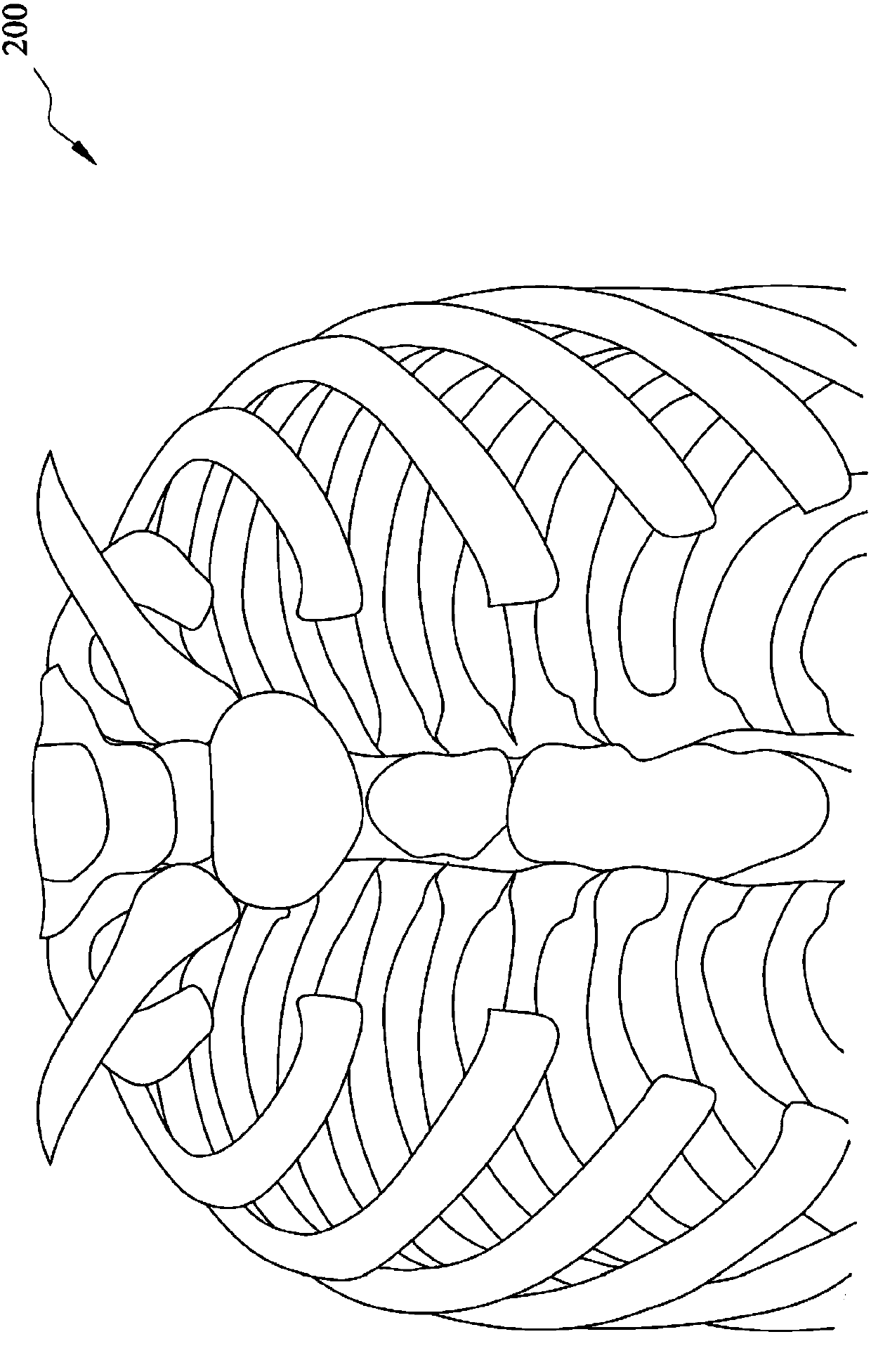 Manufacturing method applied to manufacture 3D printing simulation board of funnel chest correction board