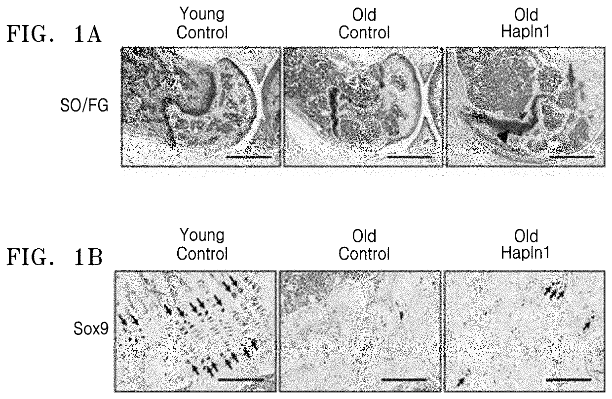 Cartilage regeneration composition containing hapln1 as active ingredient