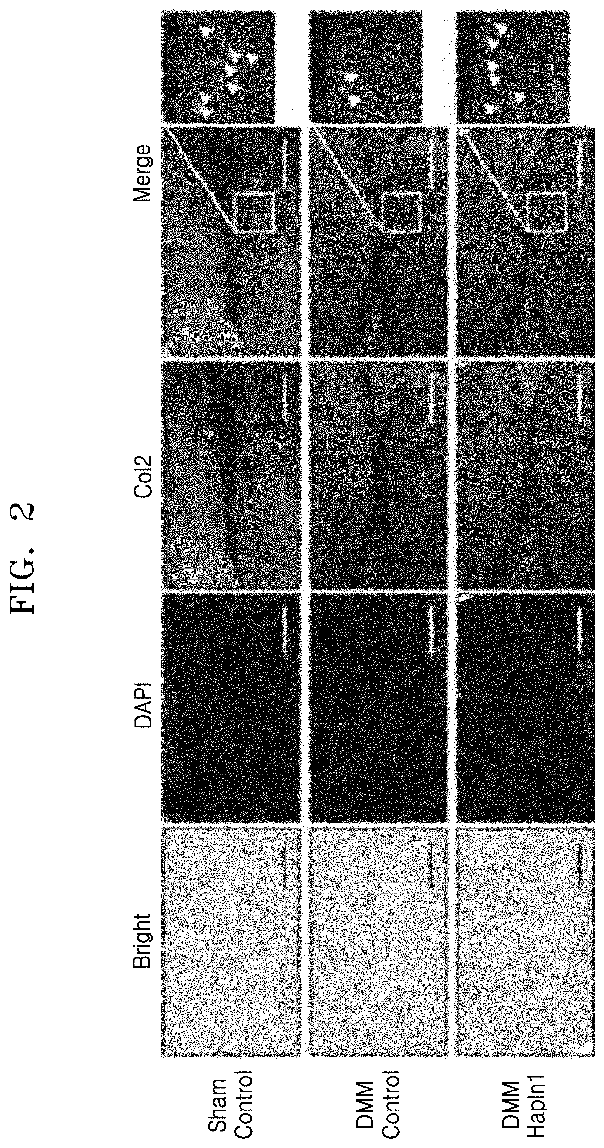 Cartilage regeneration composition containing hapln1 as active ingredient