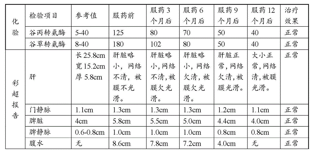 Traditional Chinese medicine used for preventing and treating liver and gall diseases, and preparation method and application thereof