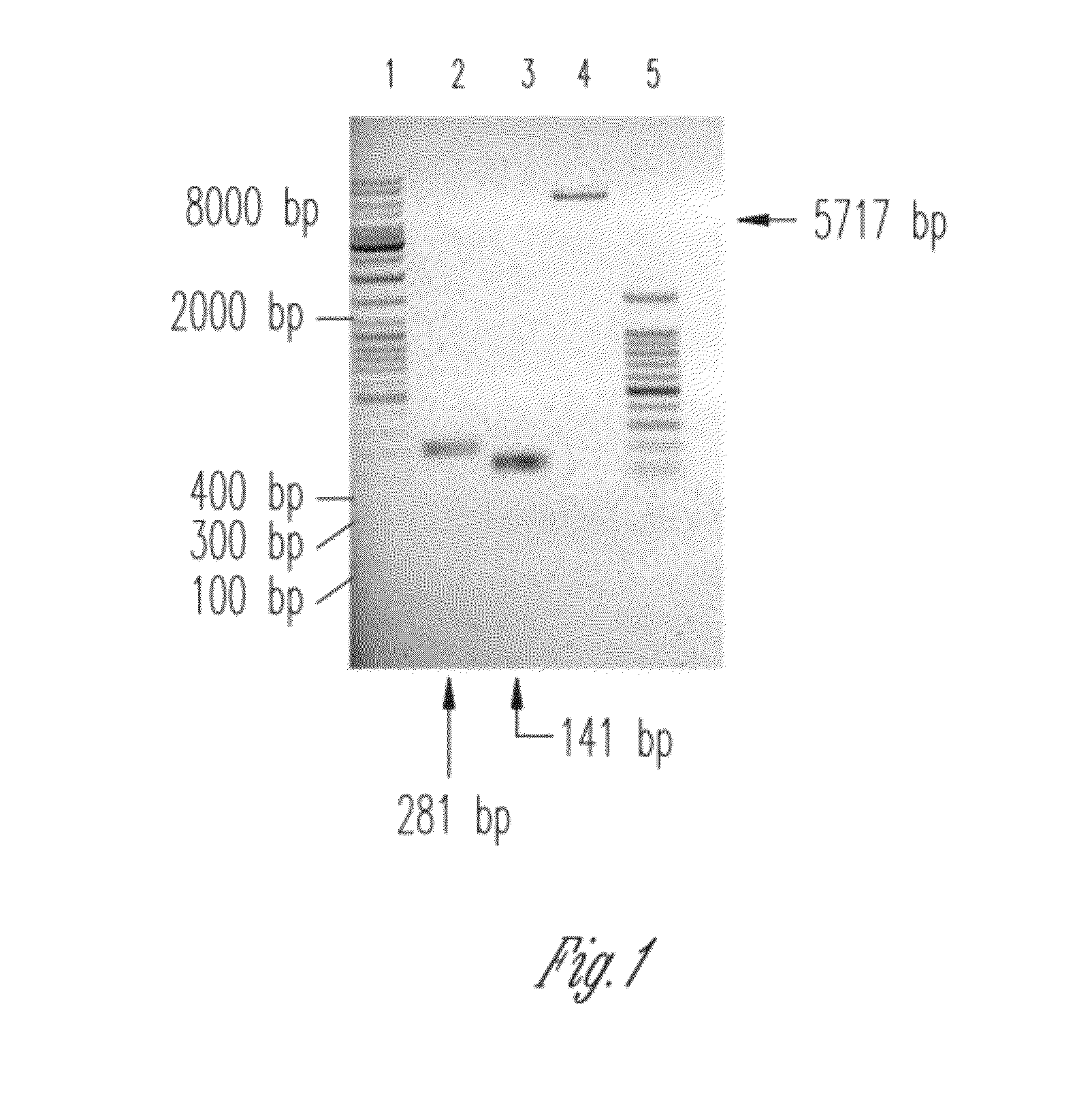 Orthogonal process for purification of recombinant human parathyroid hormone (rhPTH) (1-34)