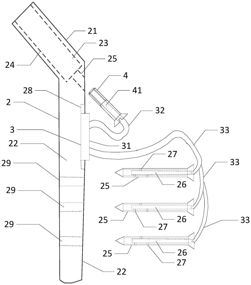 A self-circulating dynamic hip screw system for femoral head decompression