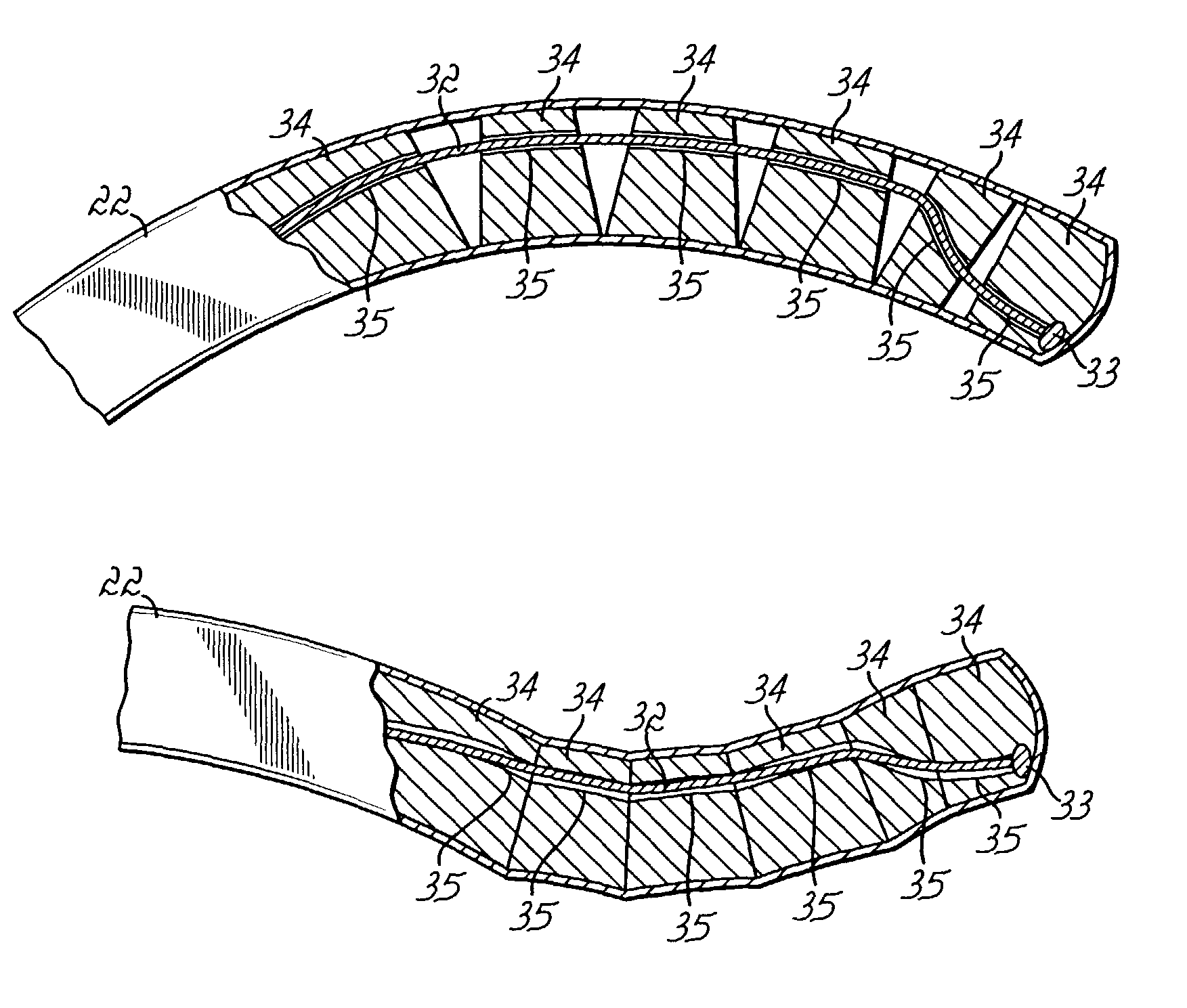 Modular power system and method for a heart wall actuation system for the natural heart