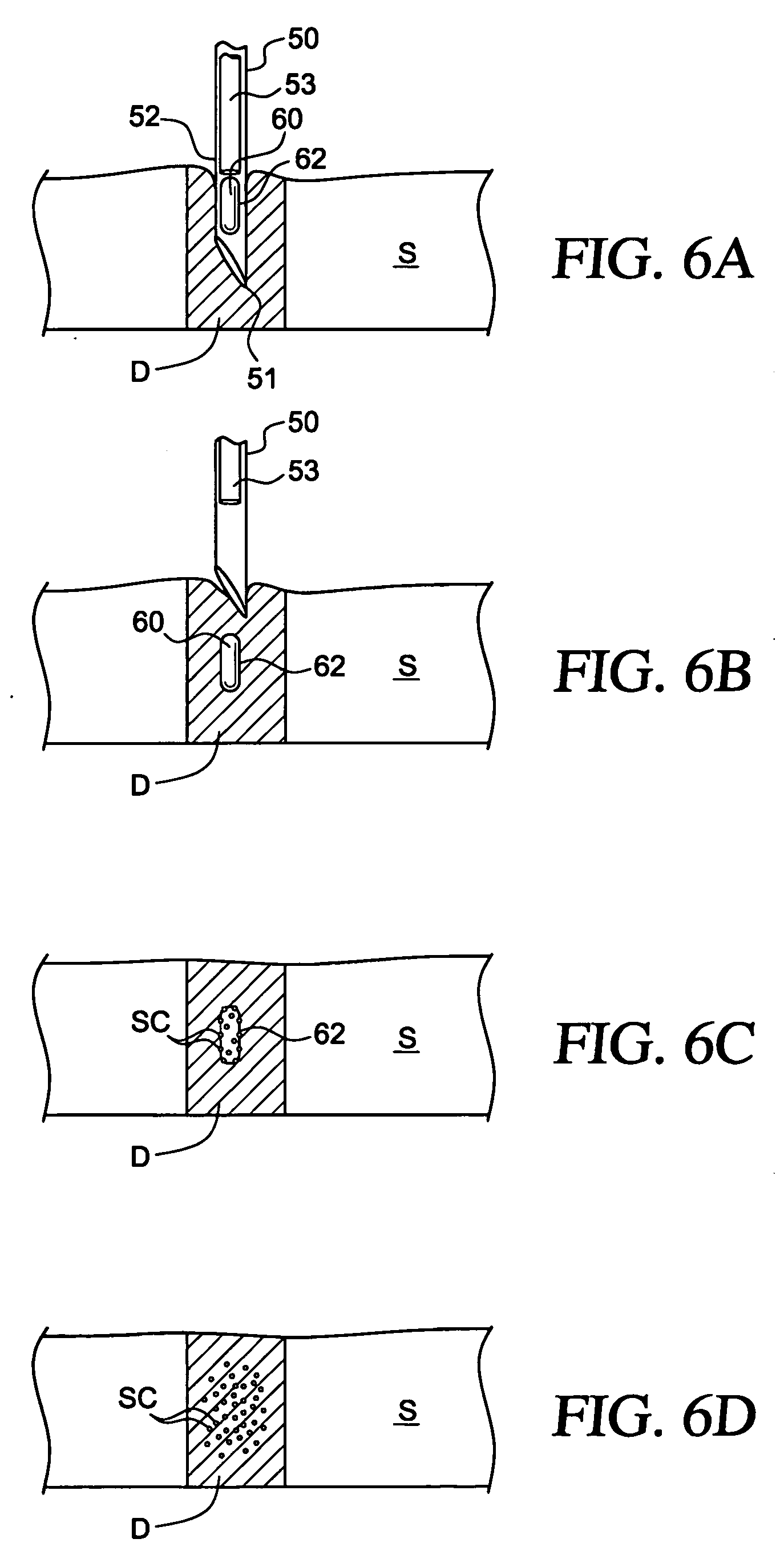 Methods and apparatus for treating an injured nerve pathway