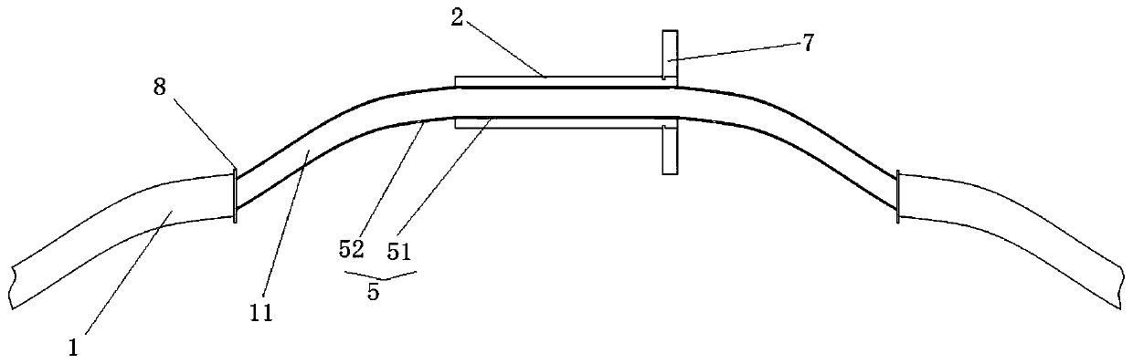 Functional trachea cannula