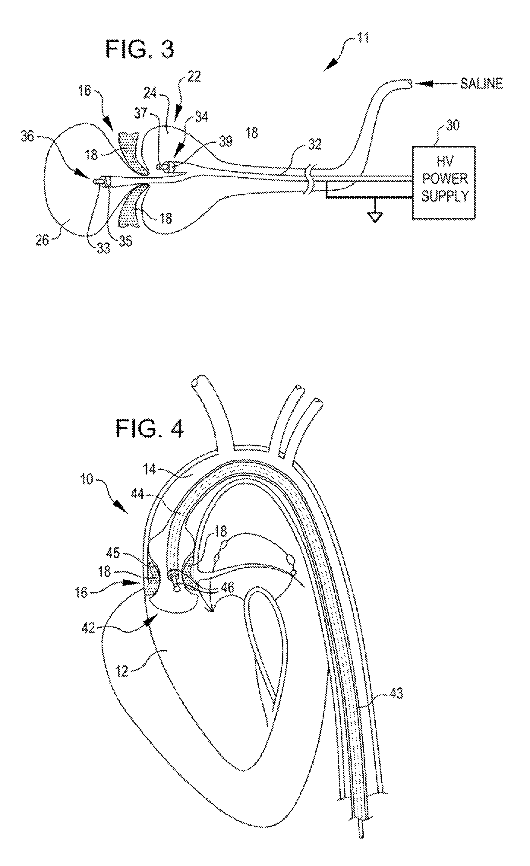 Shockwave valvuloplasty catheter system