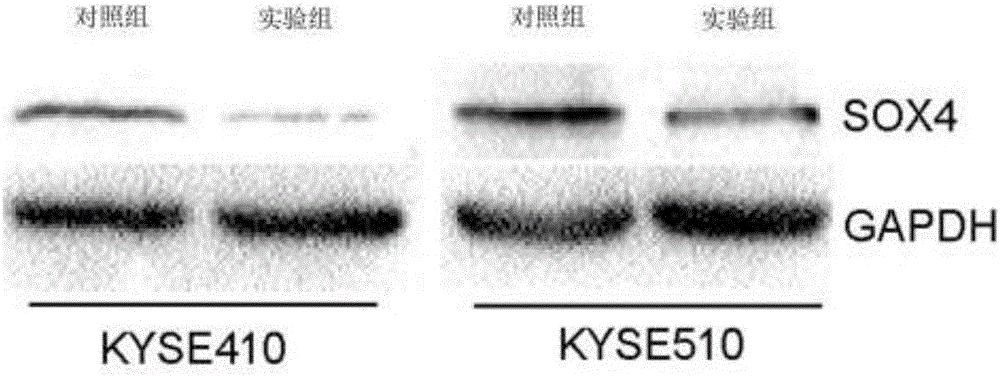 Small interfering RNA (ribonucleic acid), short hairpin RNA and recombined carrier for SOX4 gene targets, and application of recombined carrier