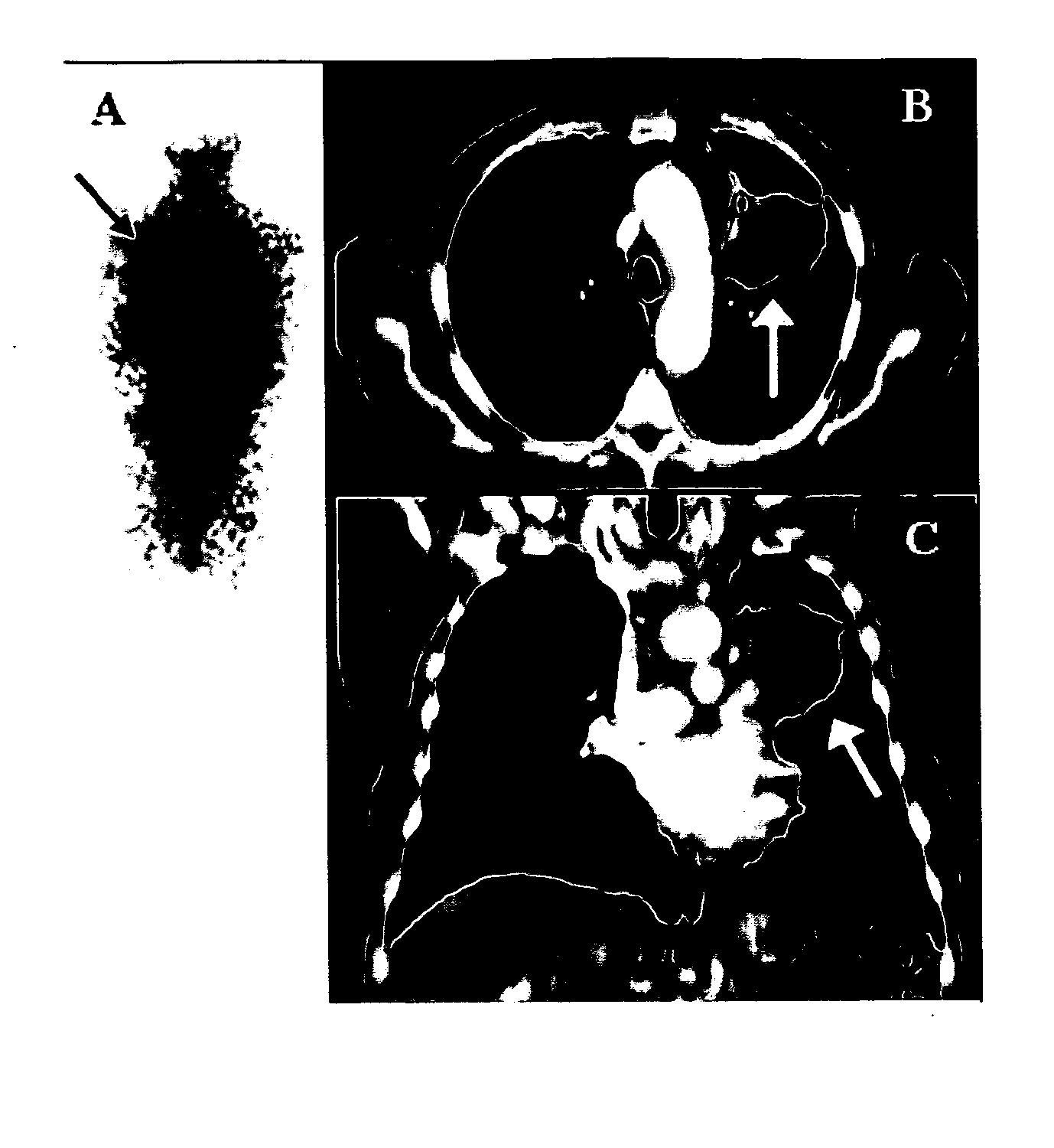 Compositions of phospholipid ether boronic acids and esters and methods for their synthesis and use