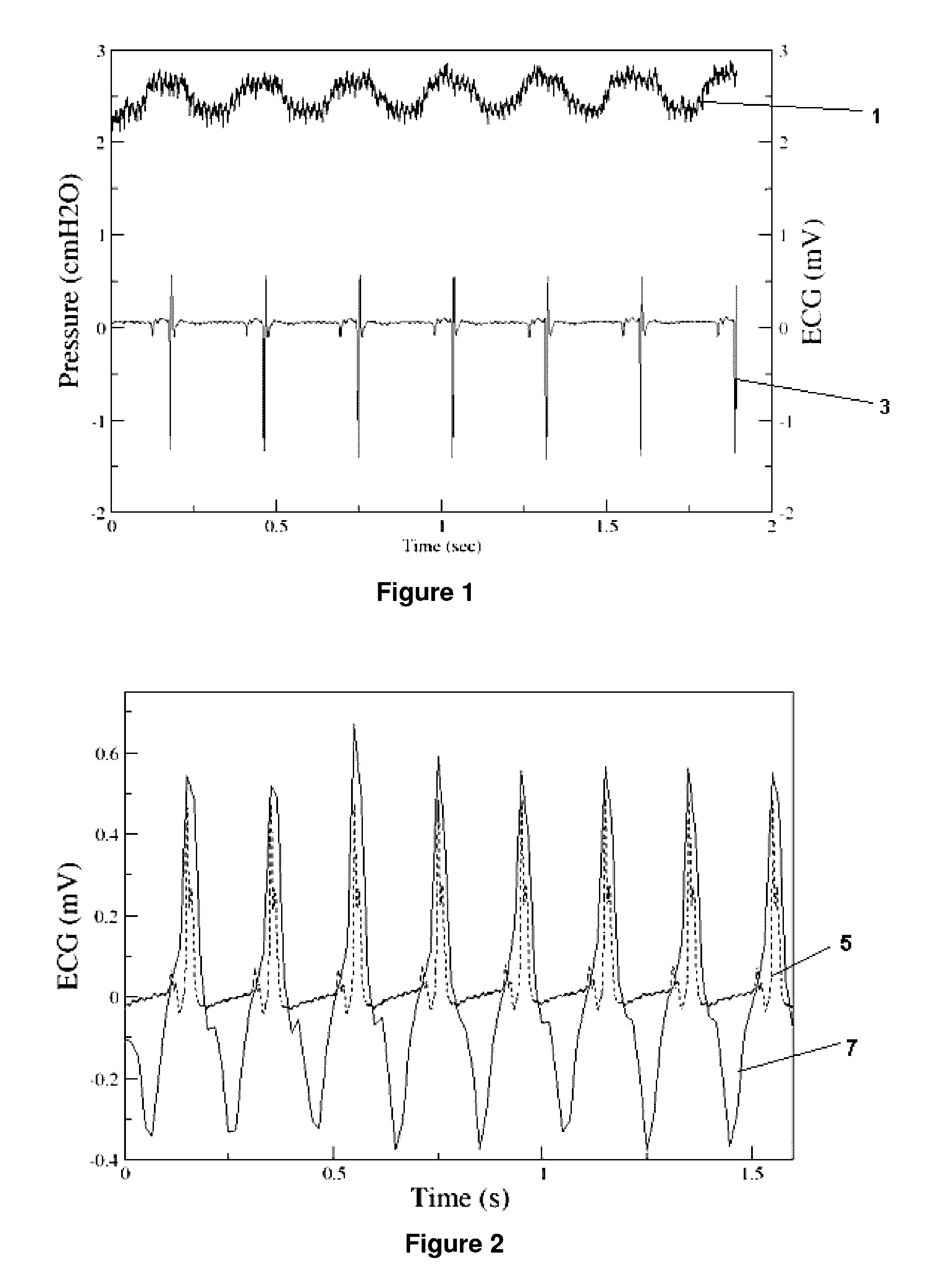 Heart imaging method