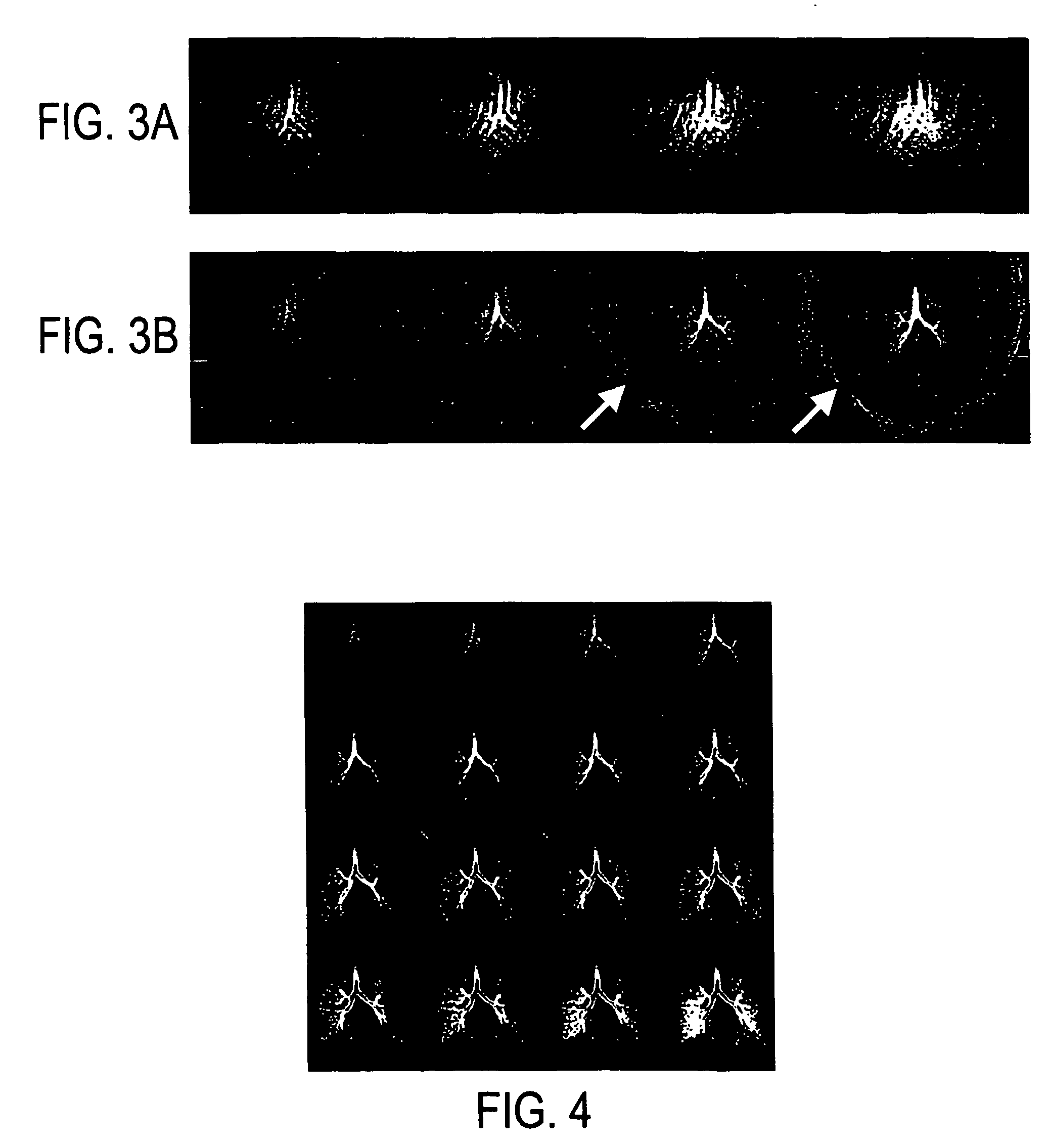 Optimized high-speed magnetic resonance imaging method and system using hyperpolarized noble gases