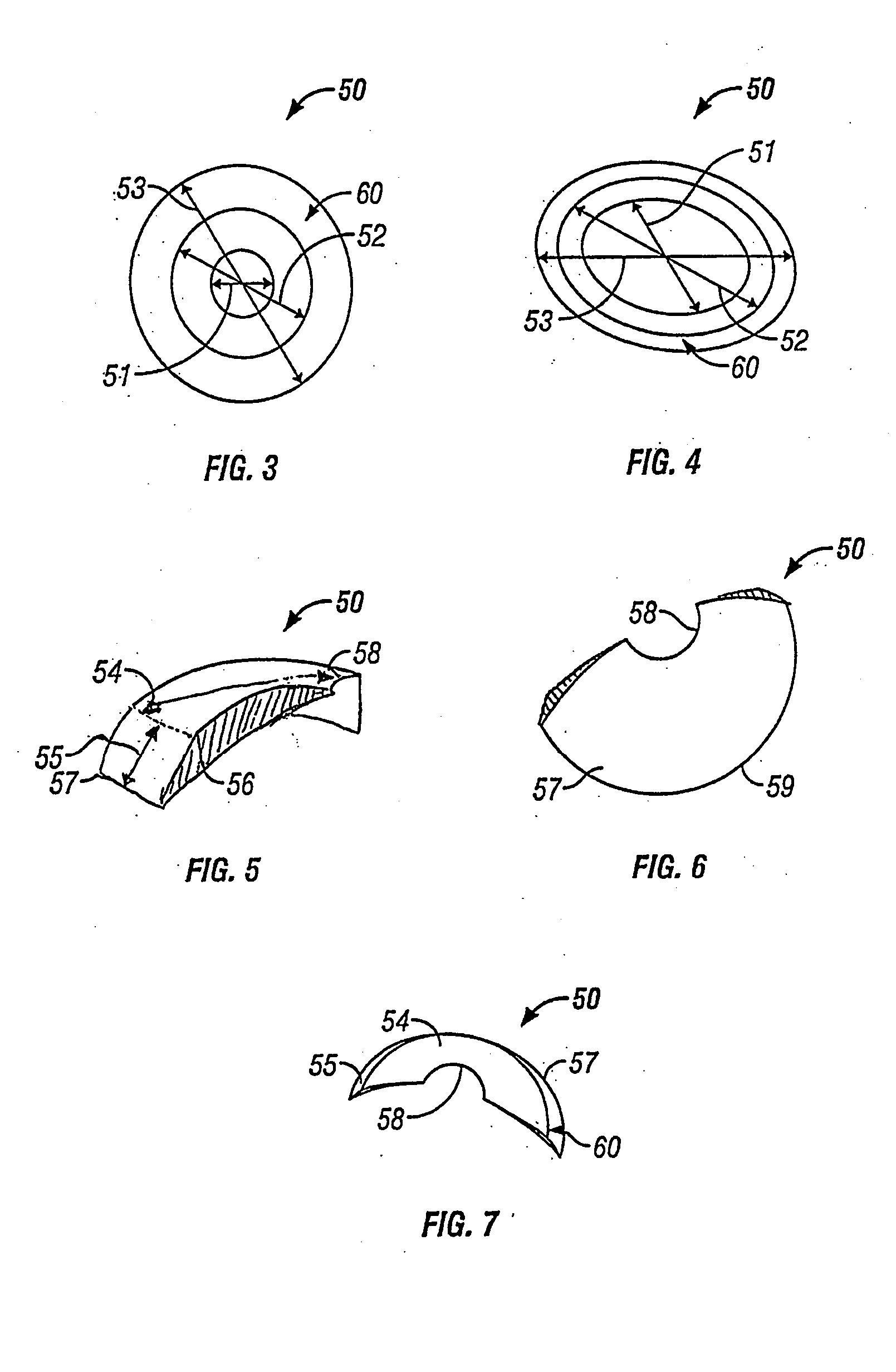 Myopic corneal ring with central accommodating portion