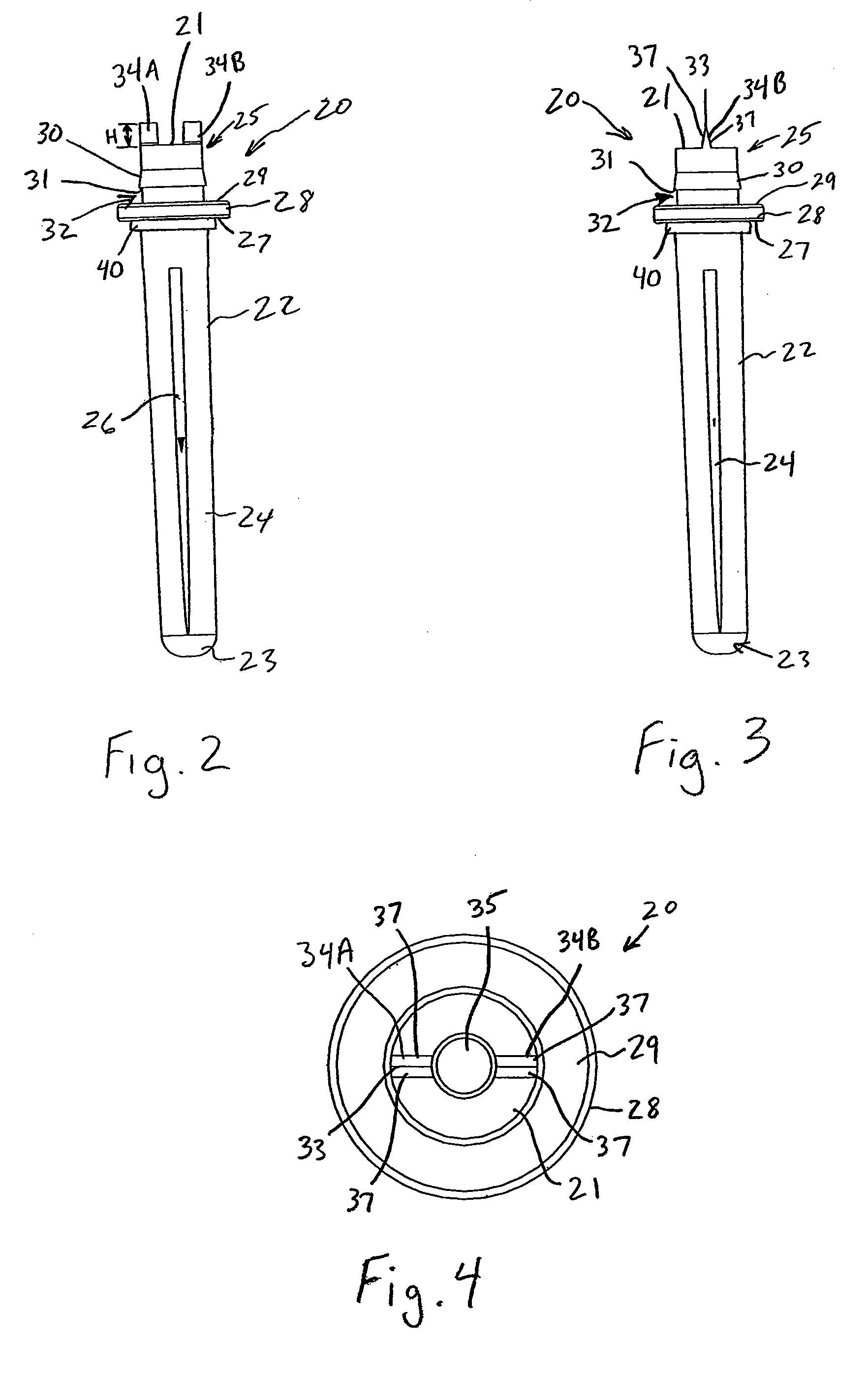 Ulnar head prosthesis system