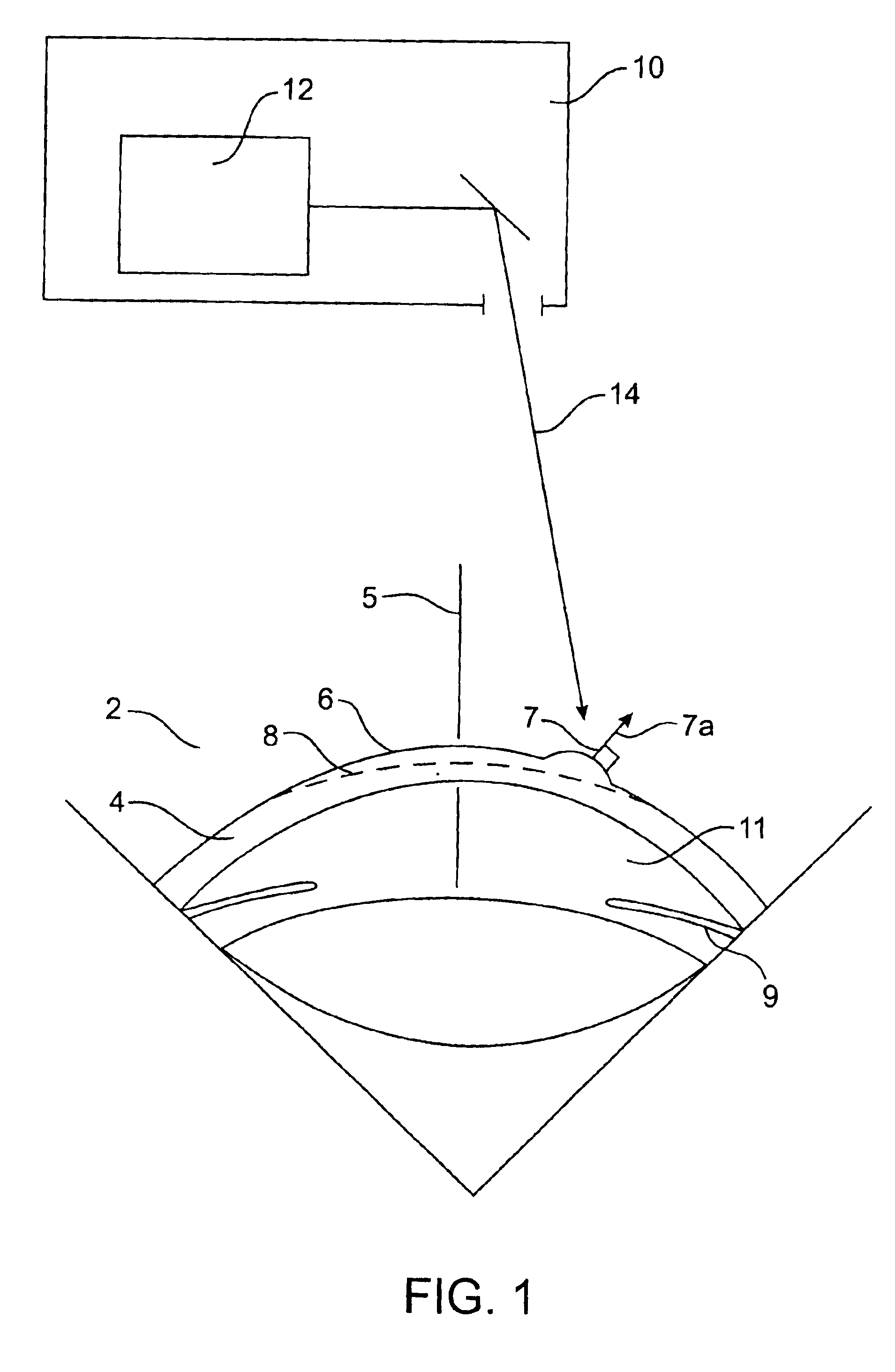 Corneal topography-based target warping