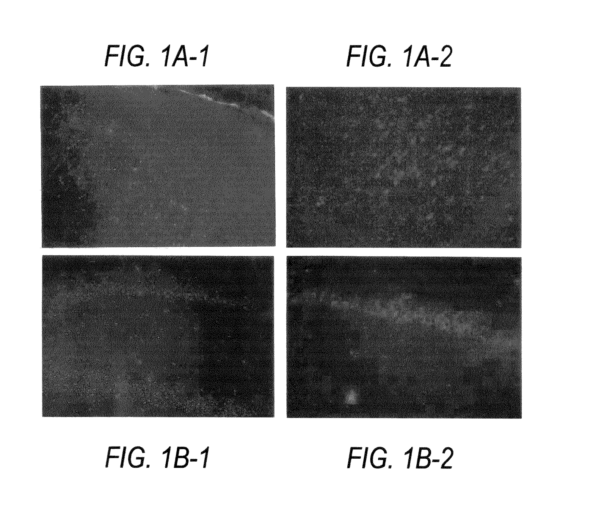 Decoy compositions for treating and preventing brain diseases and disorders