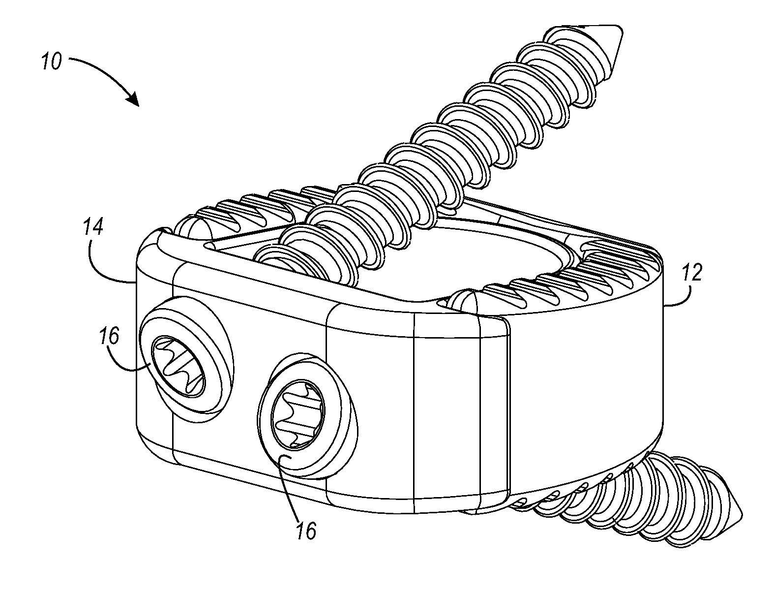 Interbody fusion device and associated methods