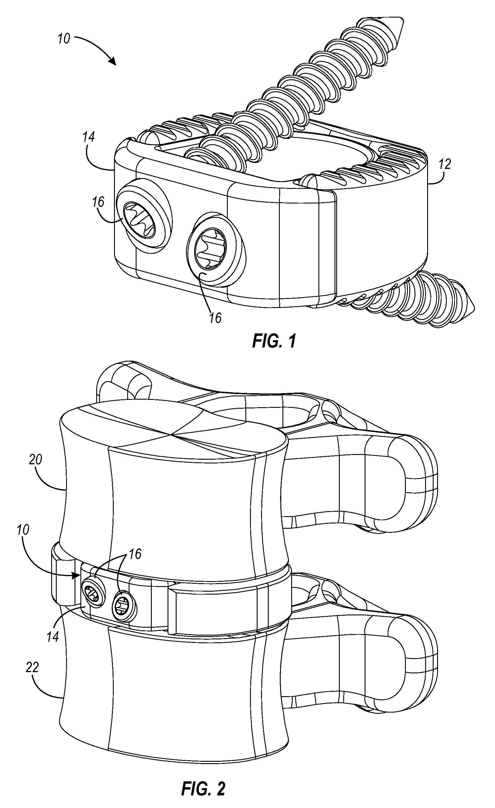 Interbody fusion device and associated methods