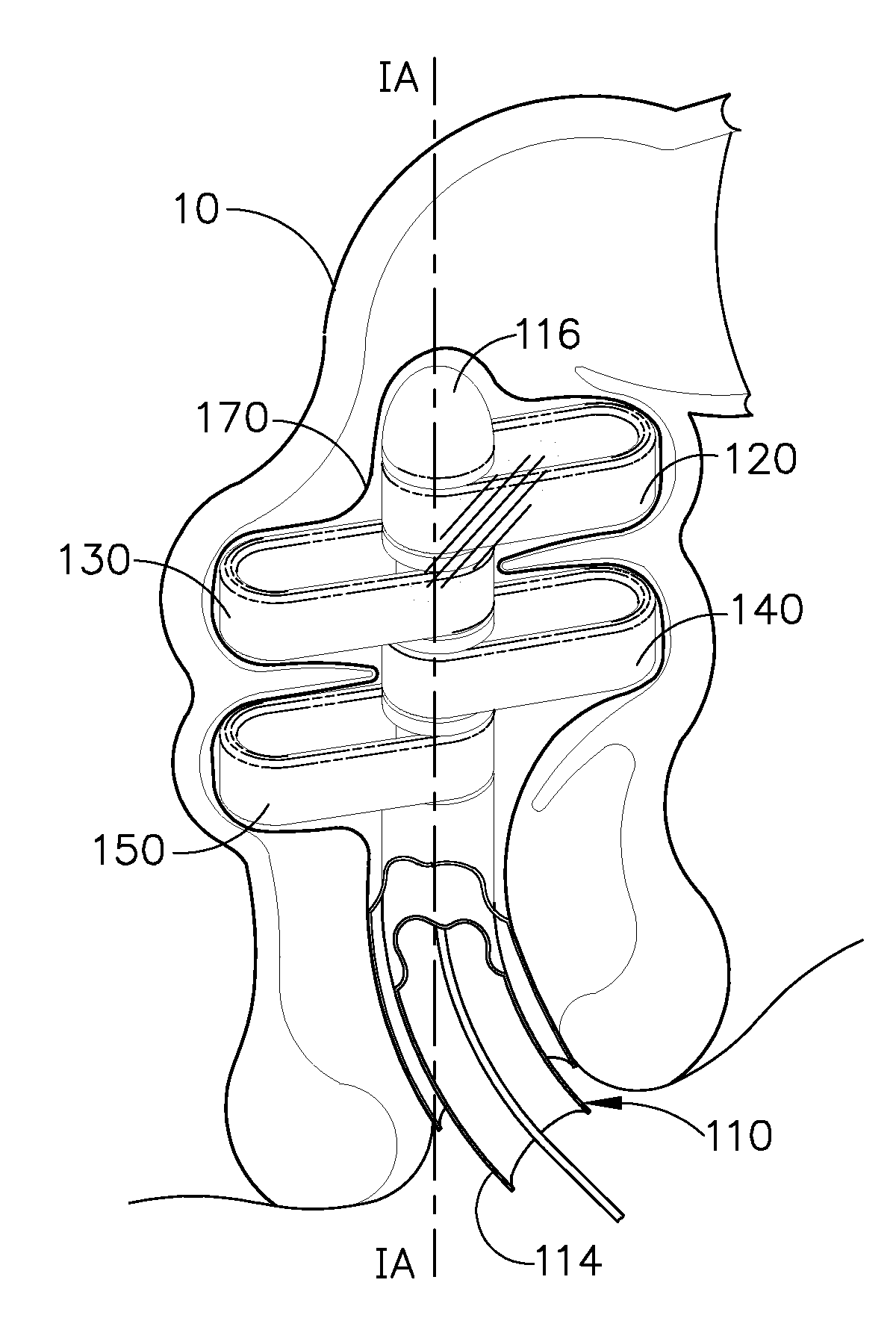 Rectal manipulation devices