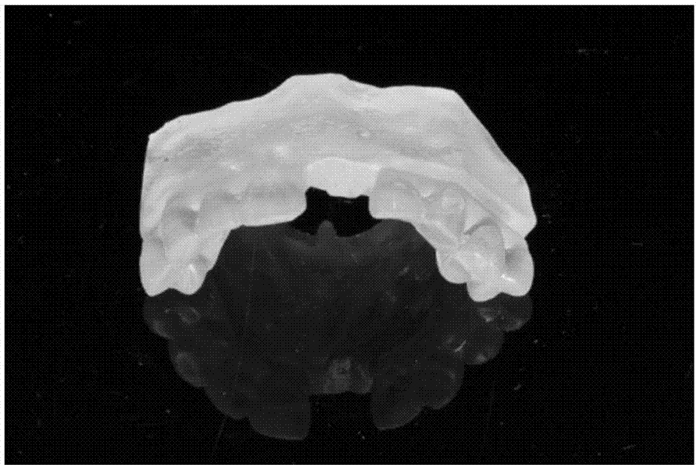 Manufacturing method for individual gingival aesthetic forming healing abutment