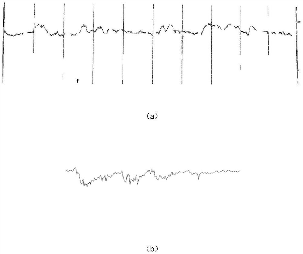 Difference background grid-oriented curve extraction method based on deep learning