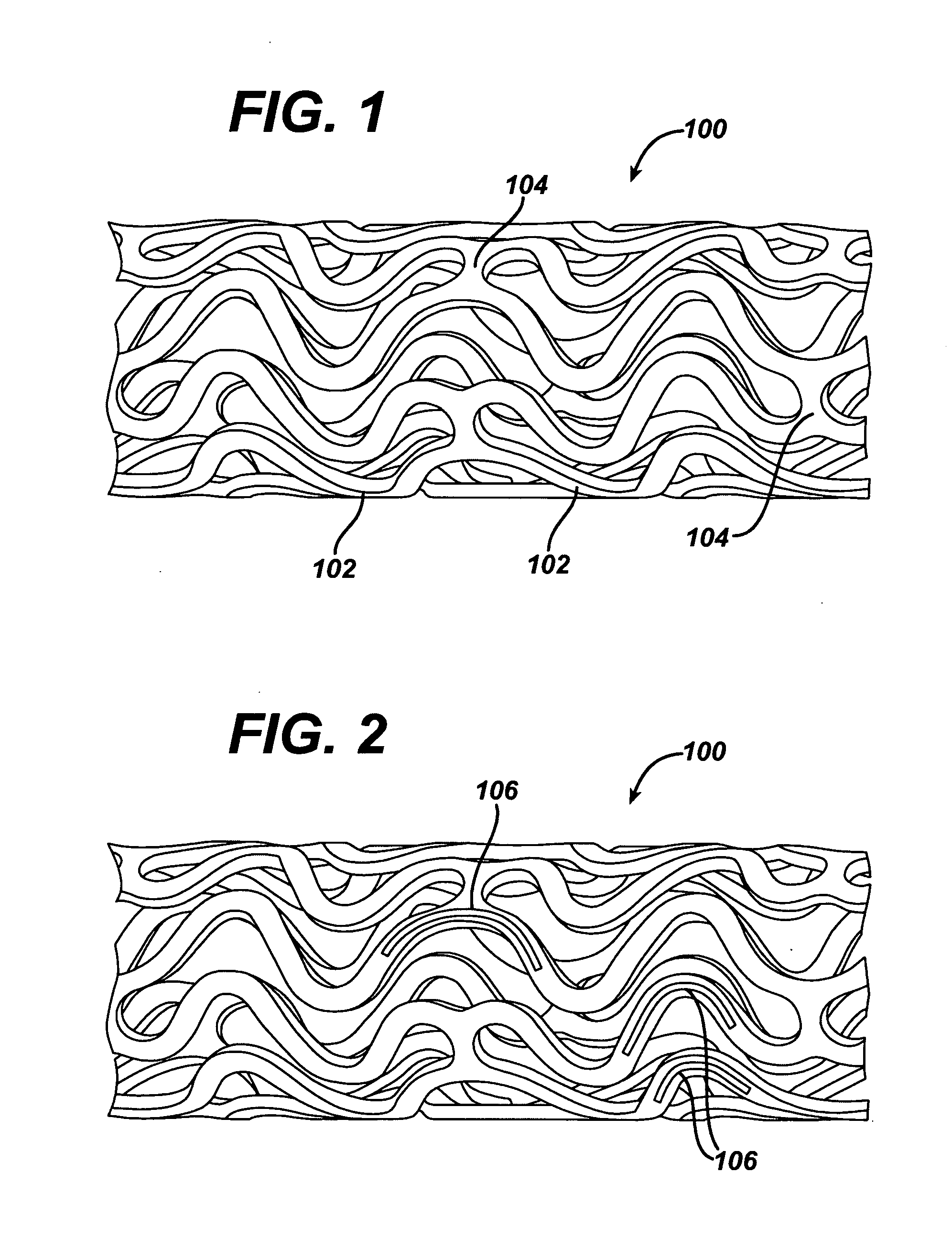 Coating for controlled release of a therapeutic agent