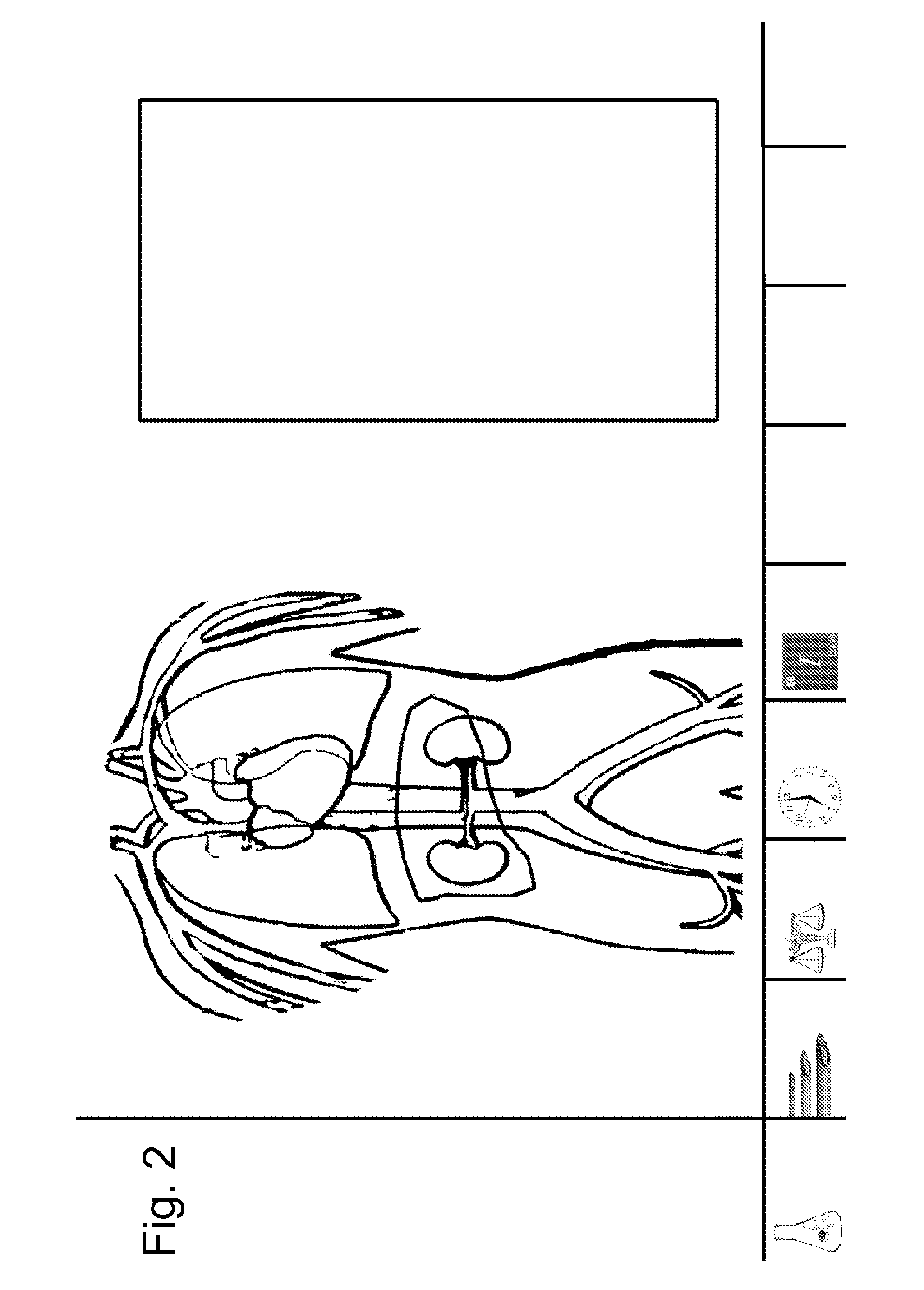 System And Apparatus For Modeling Pressures Generated During An Injection Procedure