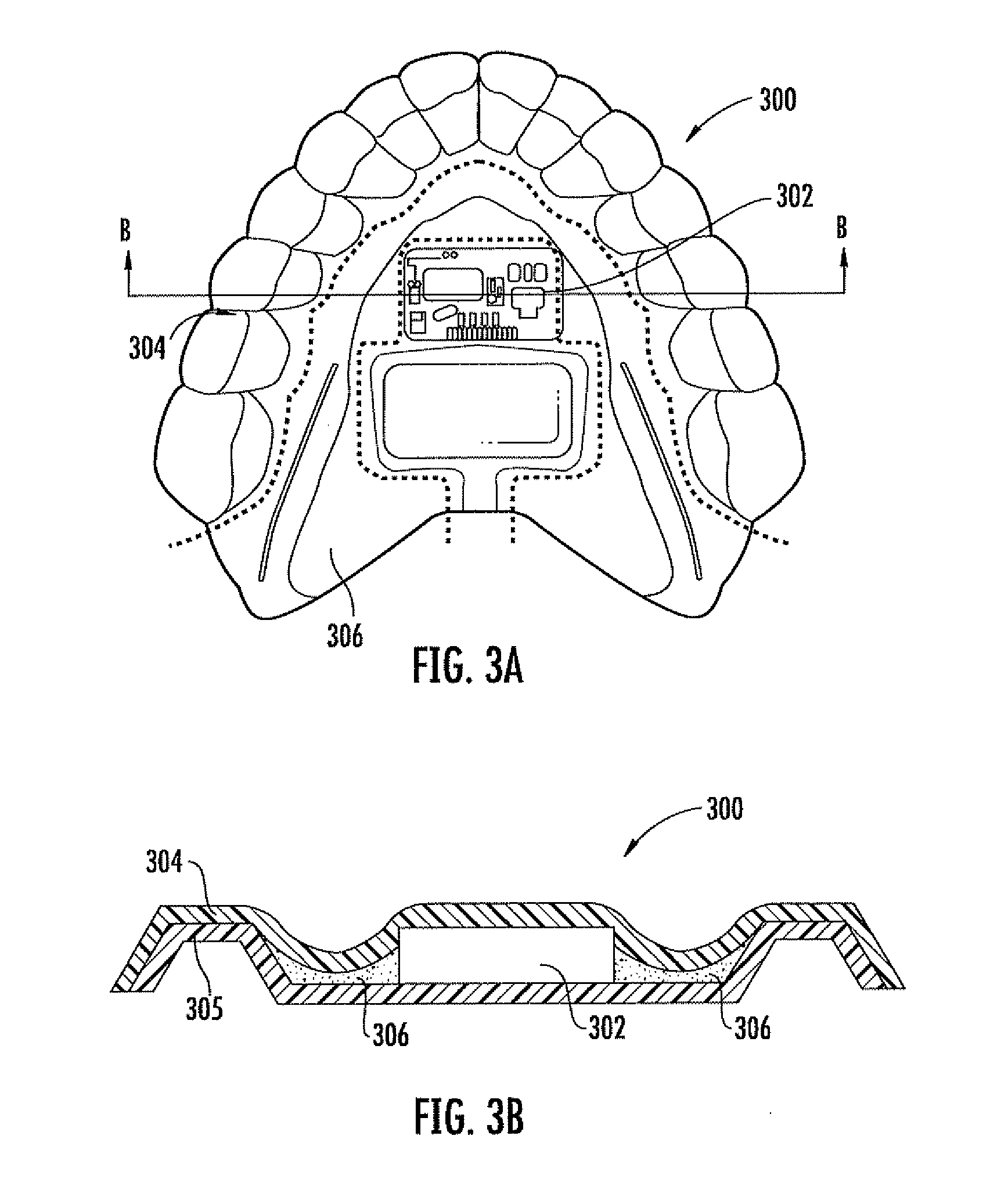 Electronic snore recording device and associated methods