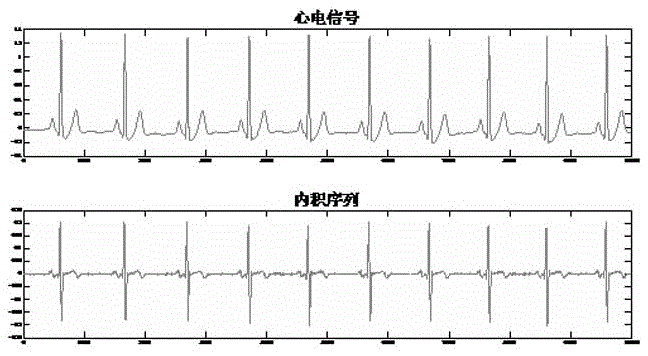 QRS wave starting point end point positioning method based on regularized least square regression learning