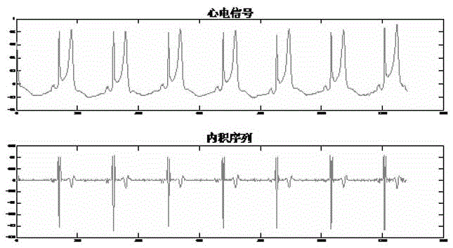 QRS wave starting point end point positioning method based on regularized least square regression learning