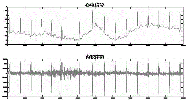 QRS wave starting point end point positioning method based on regularized least square regression learning