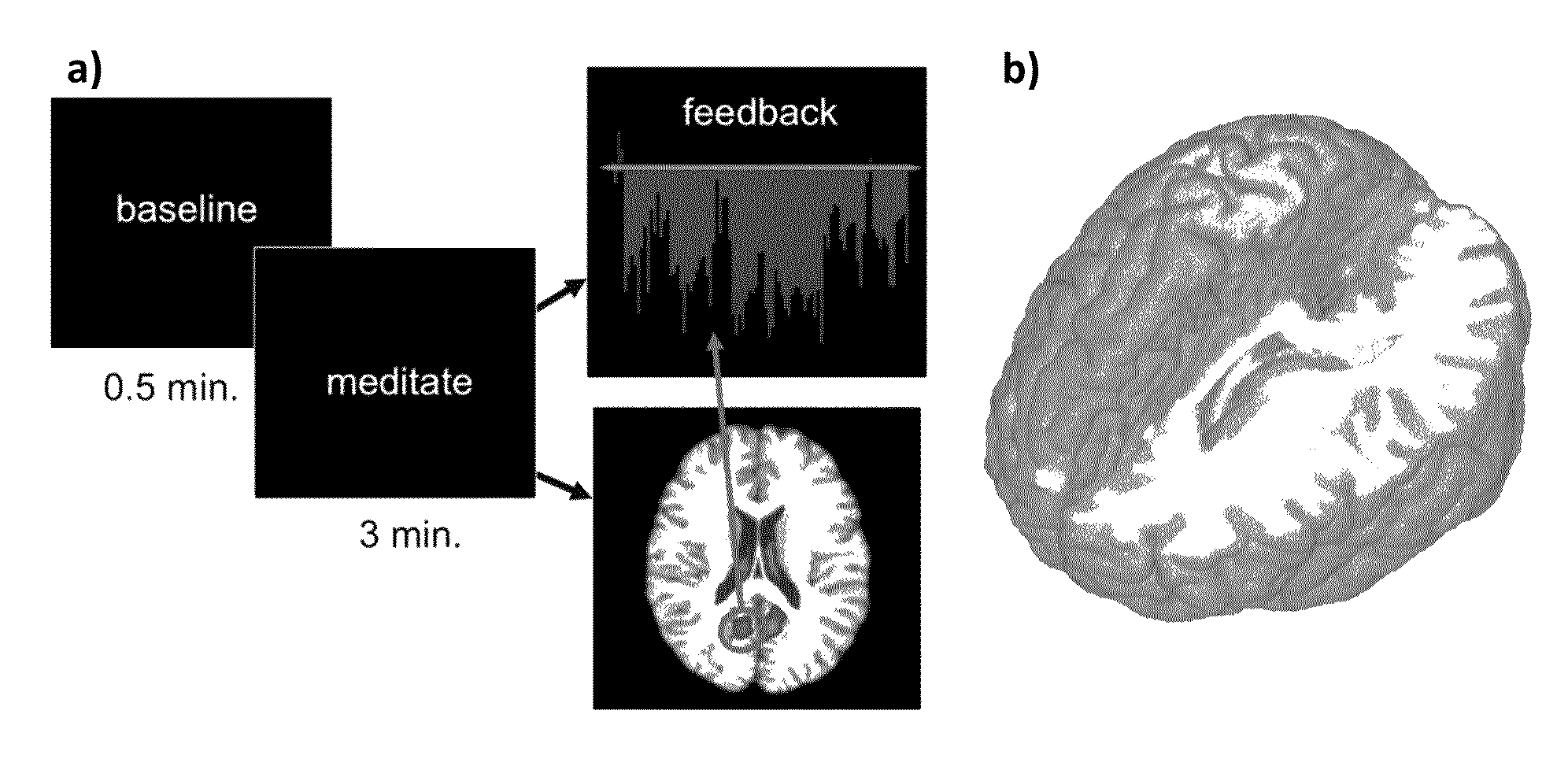 System and Method for Regulating Brain Activity