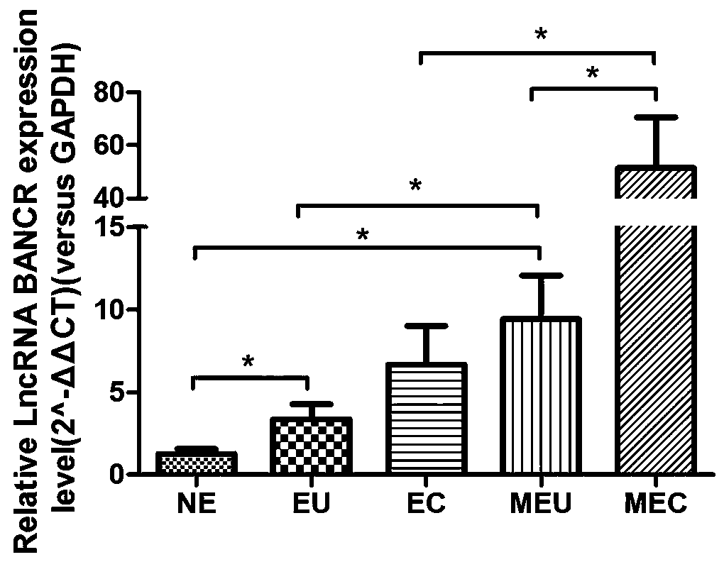 Endometriosis canceration related ovarian cancer diagnostic or prognostic marker and application