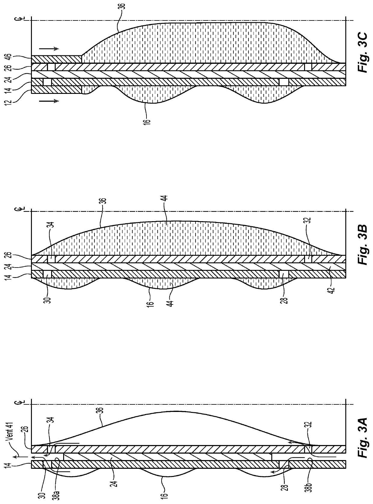 Surgical cannula with passive priming and methods for using surgical cannulas