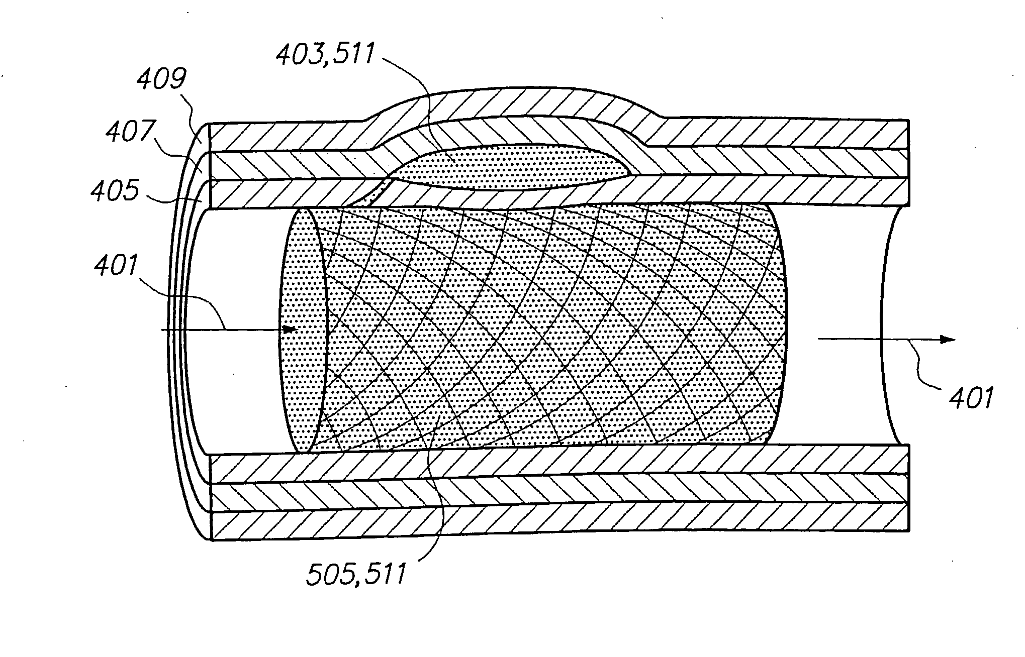 Methods for vascular reconstruction of diseased arteries