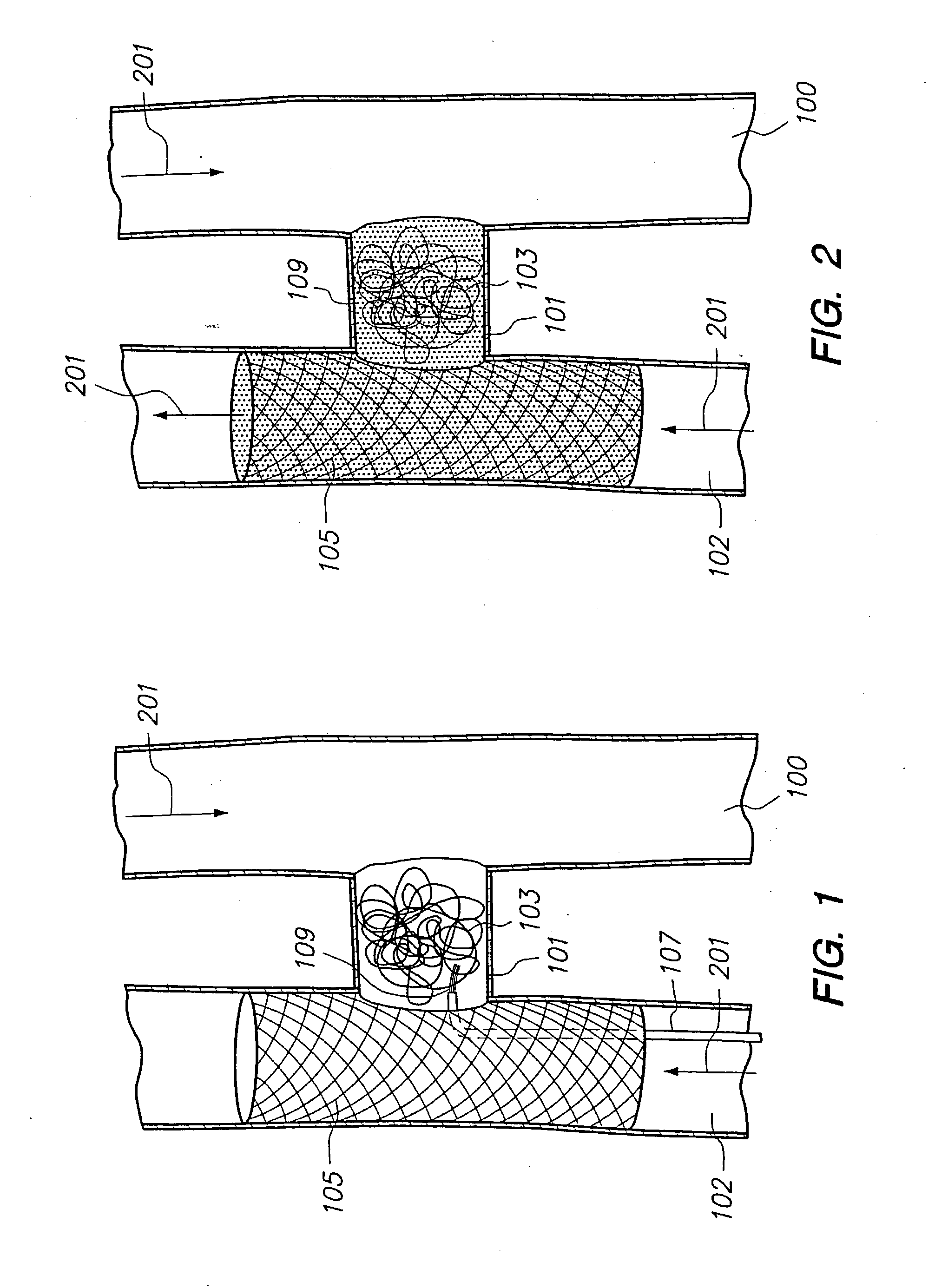 Methods for vascular reconstruction of diseased arteries