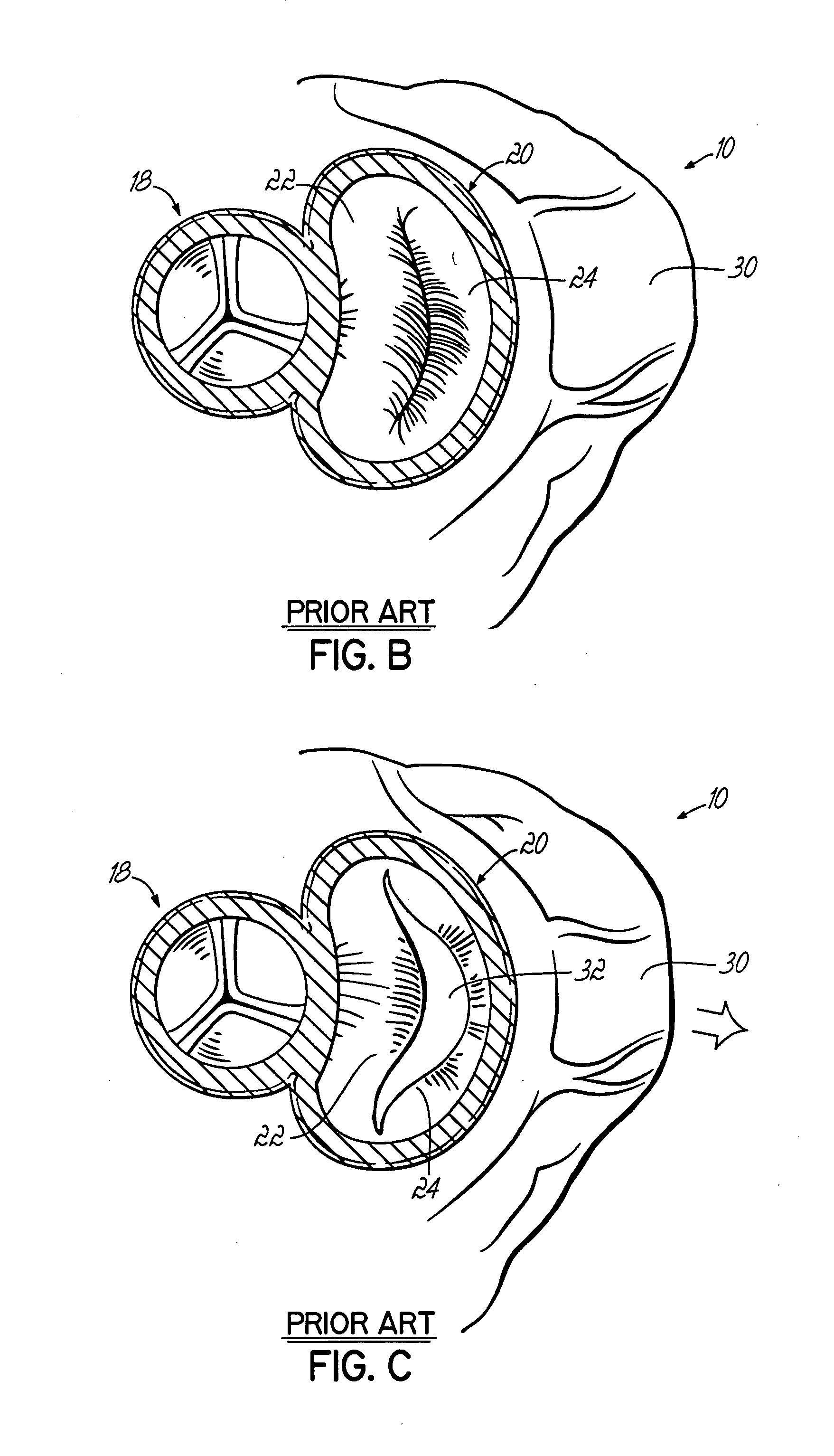 Tissue fastening systems and methods utilizing magnetic guidance