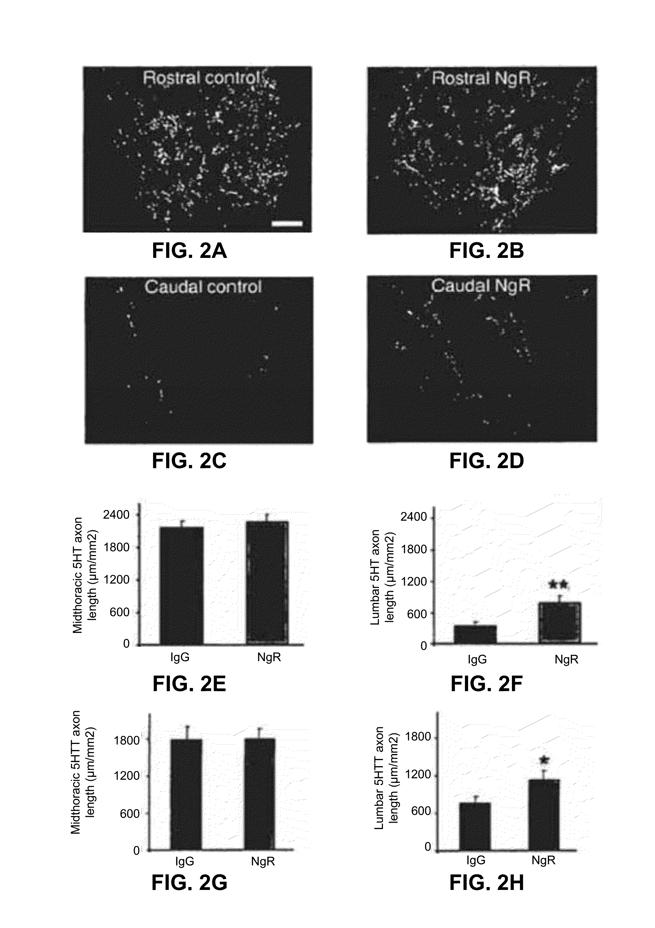 Reactivation of Axon Growth and Recovery in Chronic Spinal Cord Injury