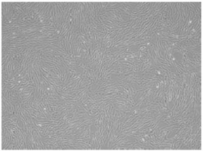 Mesenchymal stem cell, cell culture media and culture method and application