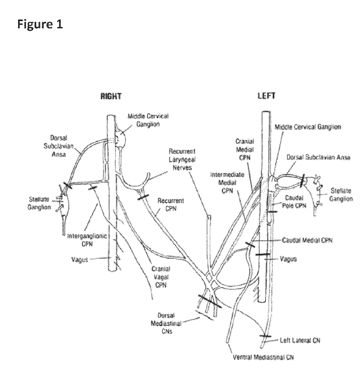 Treatment of cardiac dysfunction