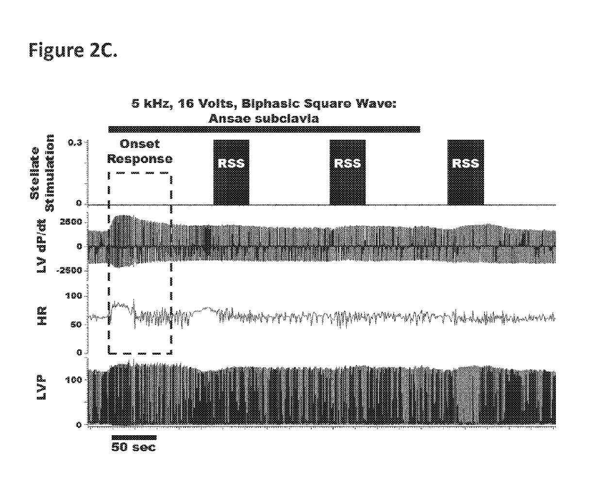 Treatment of cardiac dysfunction