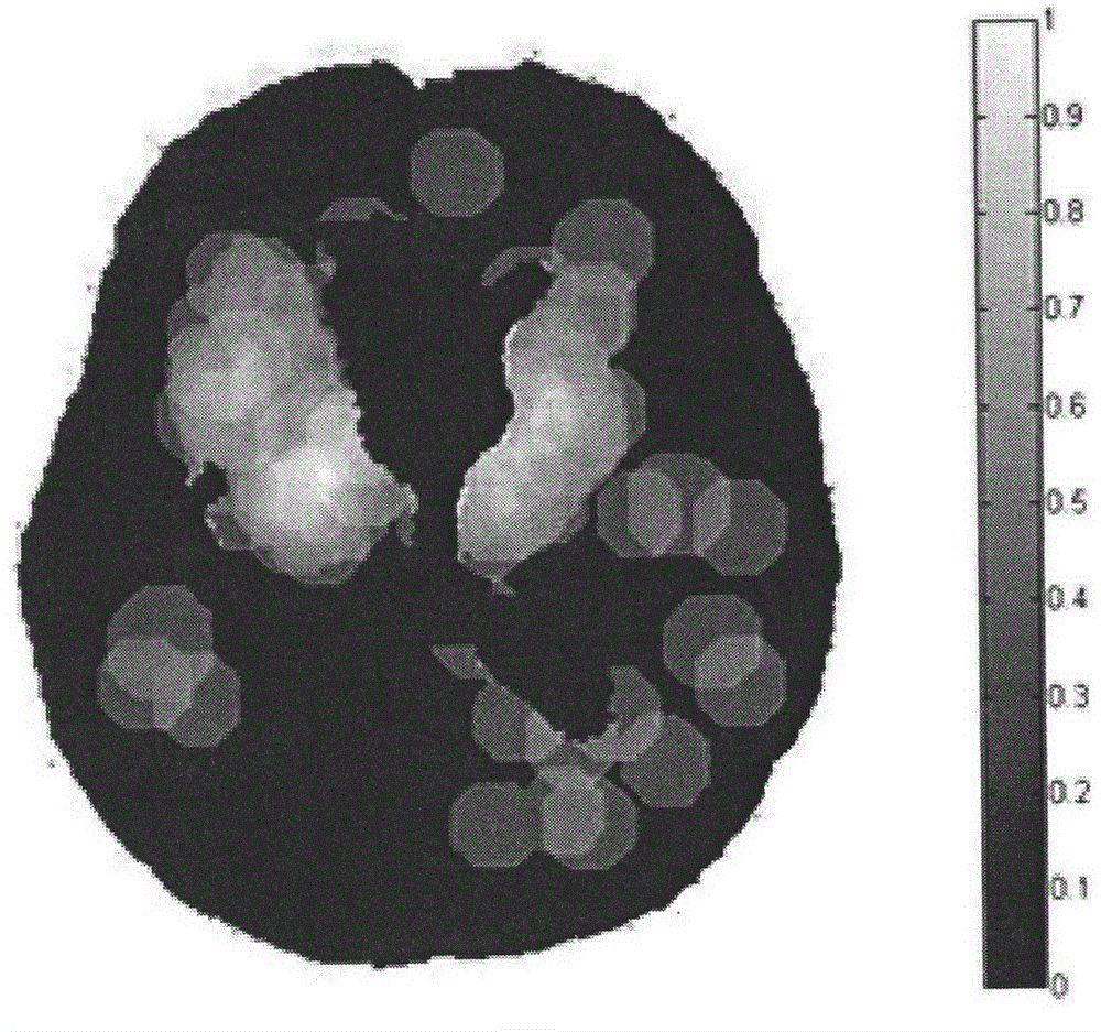 Magnetic resonance image based cerebral micro-bleeding computer auxiliary detection system