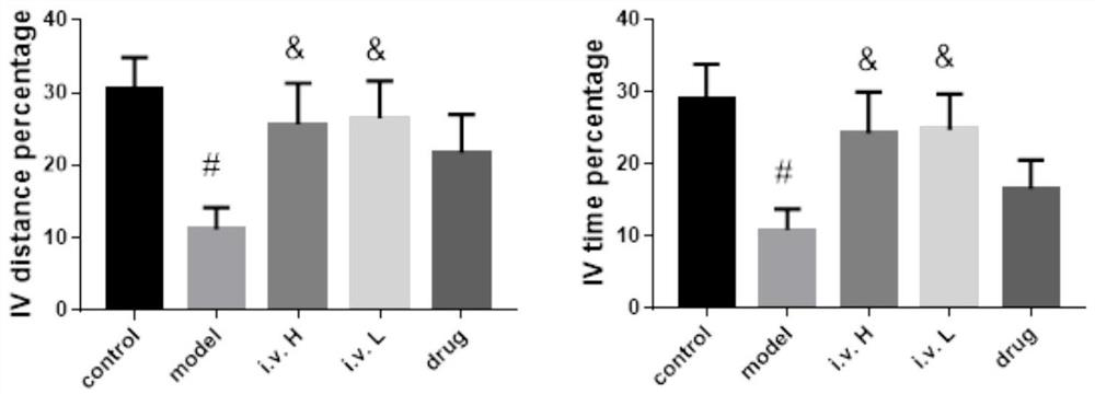 Application of dental pulp mesenchymal stem cells in preparing medicament for treating Alzheimer disease