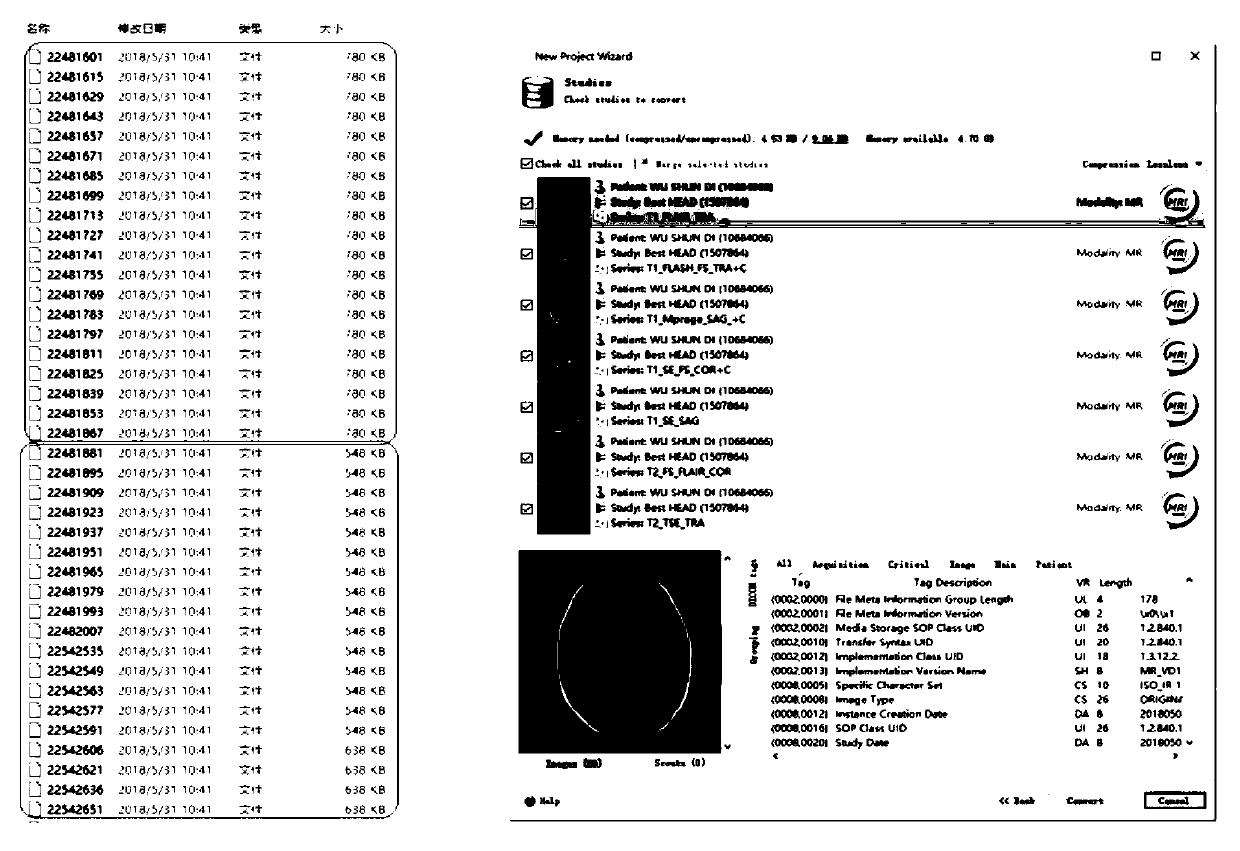 Operation assisting system and method based on medical image three-dimensional reconstruction