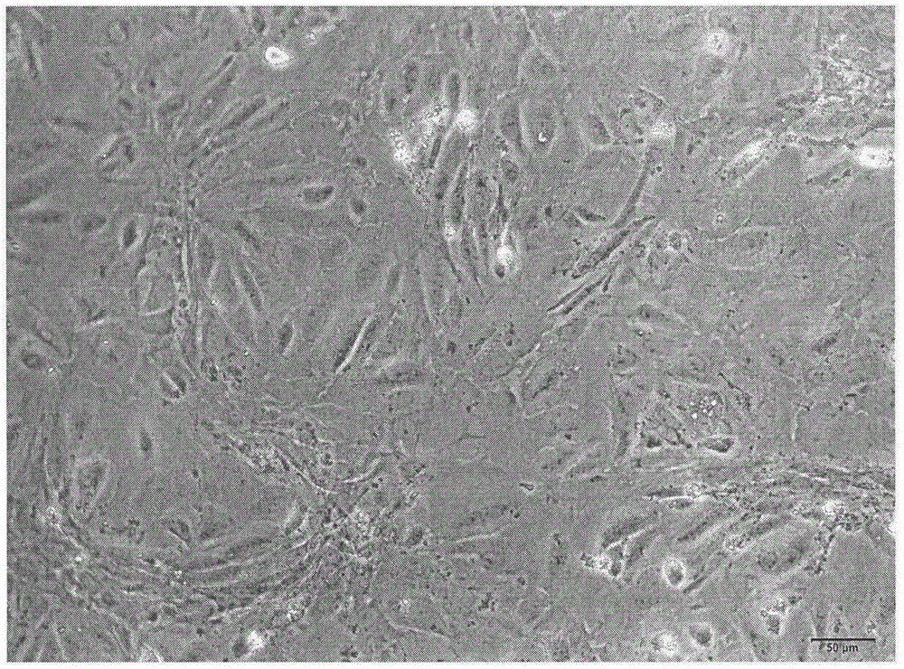 Separation and culture method of renal podocyte of mouse