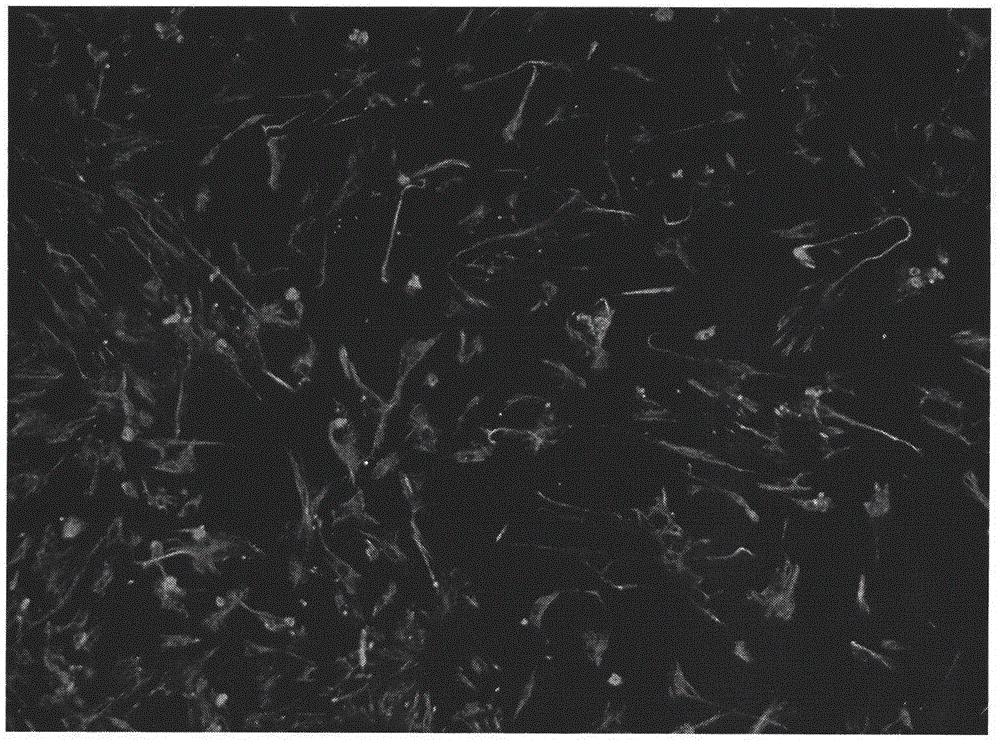 Separation and culture method of renal podocyte of mouse