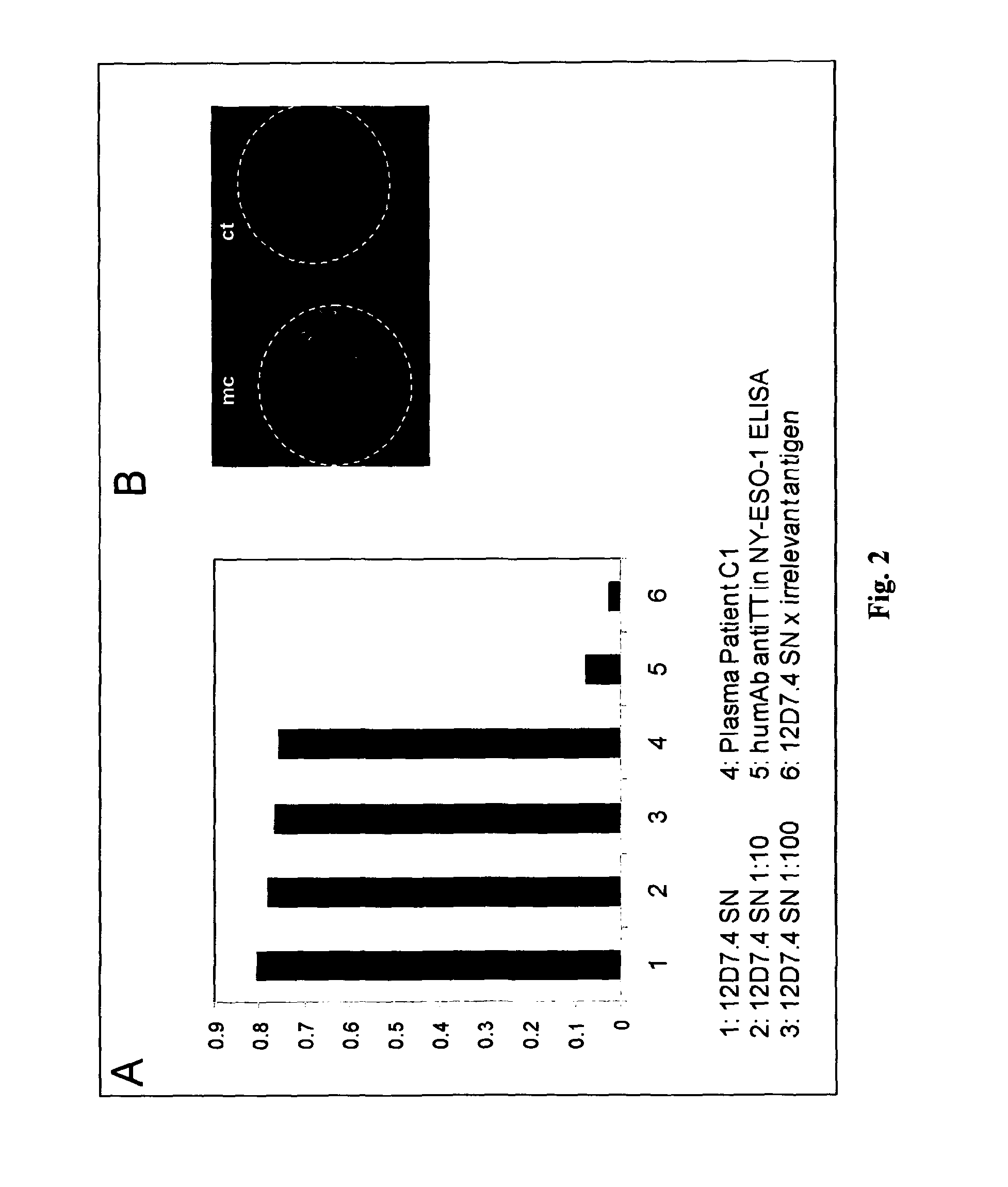 Monoclonal human tumor-specific antibody